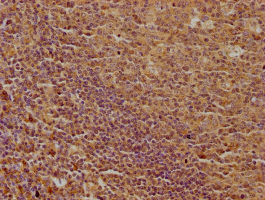 IHC image of CSB-PA013051OA01HU diluted at 1:100 and staining in paraffin-embedded human tonsil tissue performed on a Leica BondTM system. After dewaxing and hydration, antigen retrieval was mediated by high pressure in a citrate buffer (pH 6.0). Section was blocked with 10% normal goat serum 30min at RT. Then primary antibody (1% BSA) was incubated at 4°C overnight. The primary is detected by a biotinylated secondary antibody and visualized using an HRP conjugated SP system.
