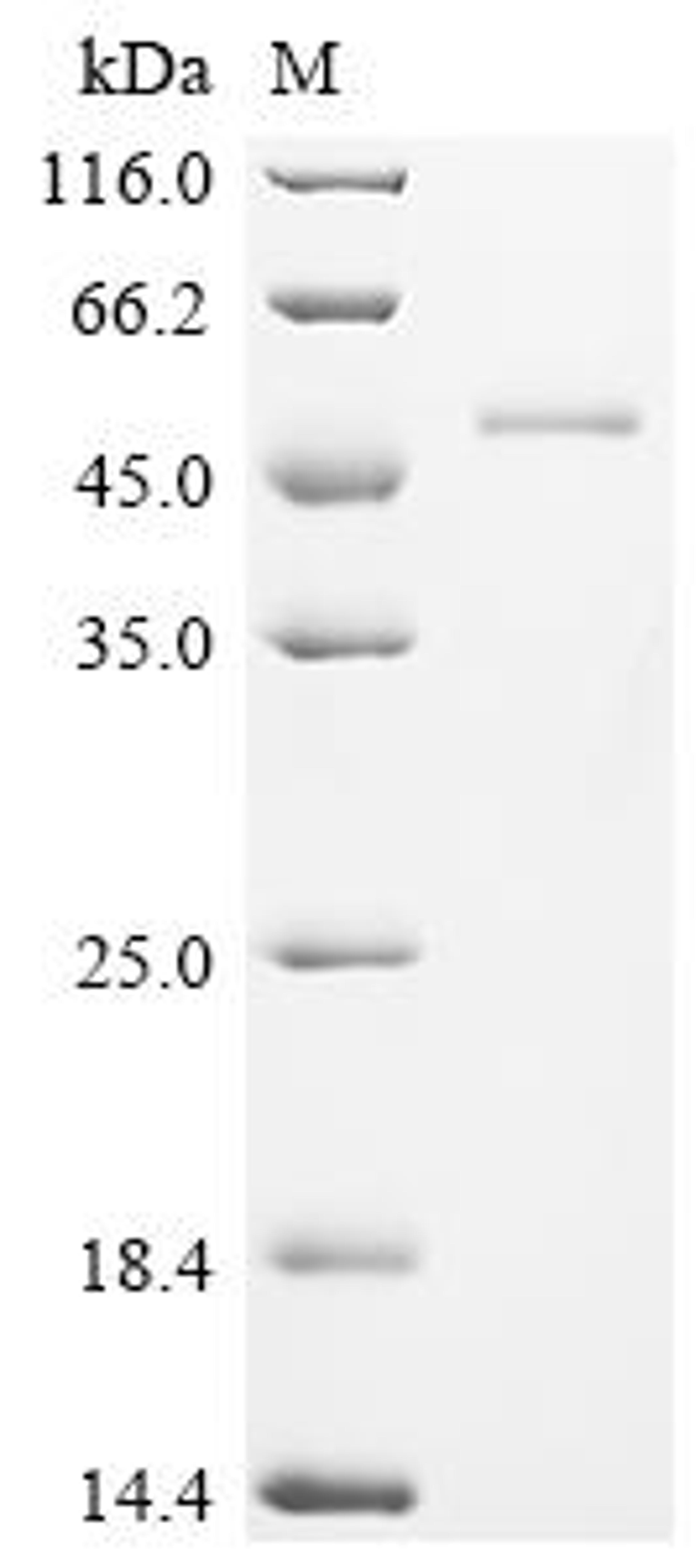 (Tris-Glycine gel) Discontinuous SDS-PAGE (reduced) with 5% enrichment gel and 15% separation gel.