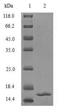 (Tris-Glycine gel) Discontinuous SDS-PAGE (reduced) with 5% enrichment gel and 15% separation gel.