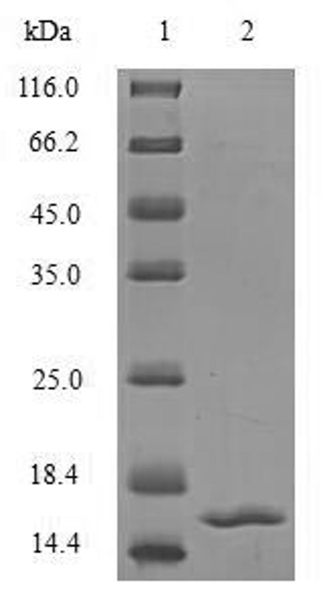 (Tris-Glycine gel) Discontinuous SDS-PAGE (reduced) with 5% enrichment gel and 15% separation gel.