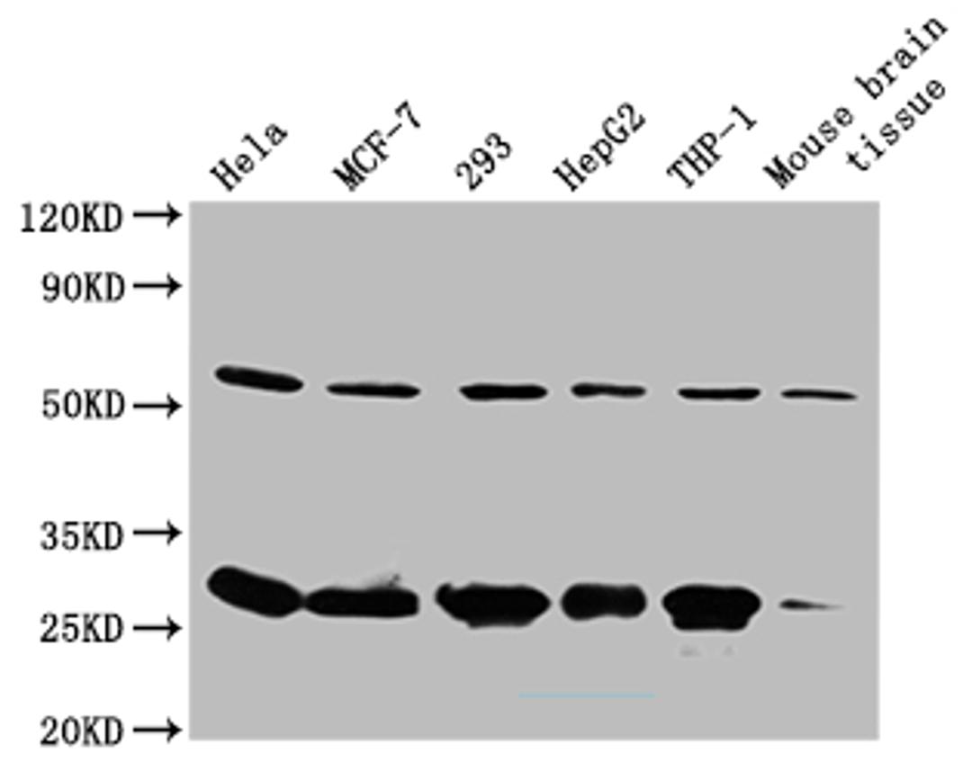 Western Blot. Positive WB detected in: Mouse spleen tissue. All lanes: RPL19 antibody at 2ug/ml. Secondary. Goat polyclonal to rabbit IgG at 1/50000 dilution. Predicted band size: 24 kDa. Observed band size: 24 kDa. 