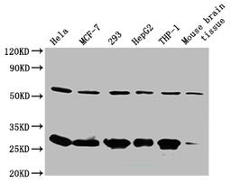 Western Blot. Positive WB detected in: Mouse spleen tissue. All lanes: RPL19 antibody at 2ug/ml. Secondary. Goat polyclonal to rabbit IgG at 1/50000 dilution. Predicted band size: 24 kDa. Observed band size: 24 kDa. 