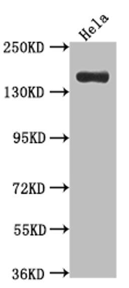 Western Blot. Positive WB detected in: Hela whole cell lysate. All lanes: Xanthine Oxidase antibody at 1:1000. Secondary. Goat polyclonal to rabbit IgG at 1/50000 dilution. Predicted band size: 147 kDa. Observed band size: 147 kDa. 