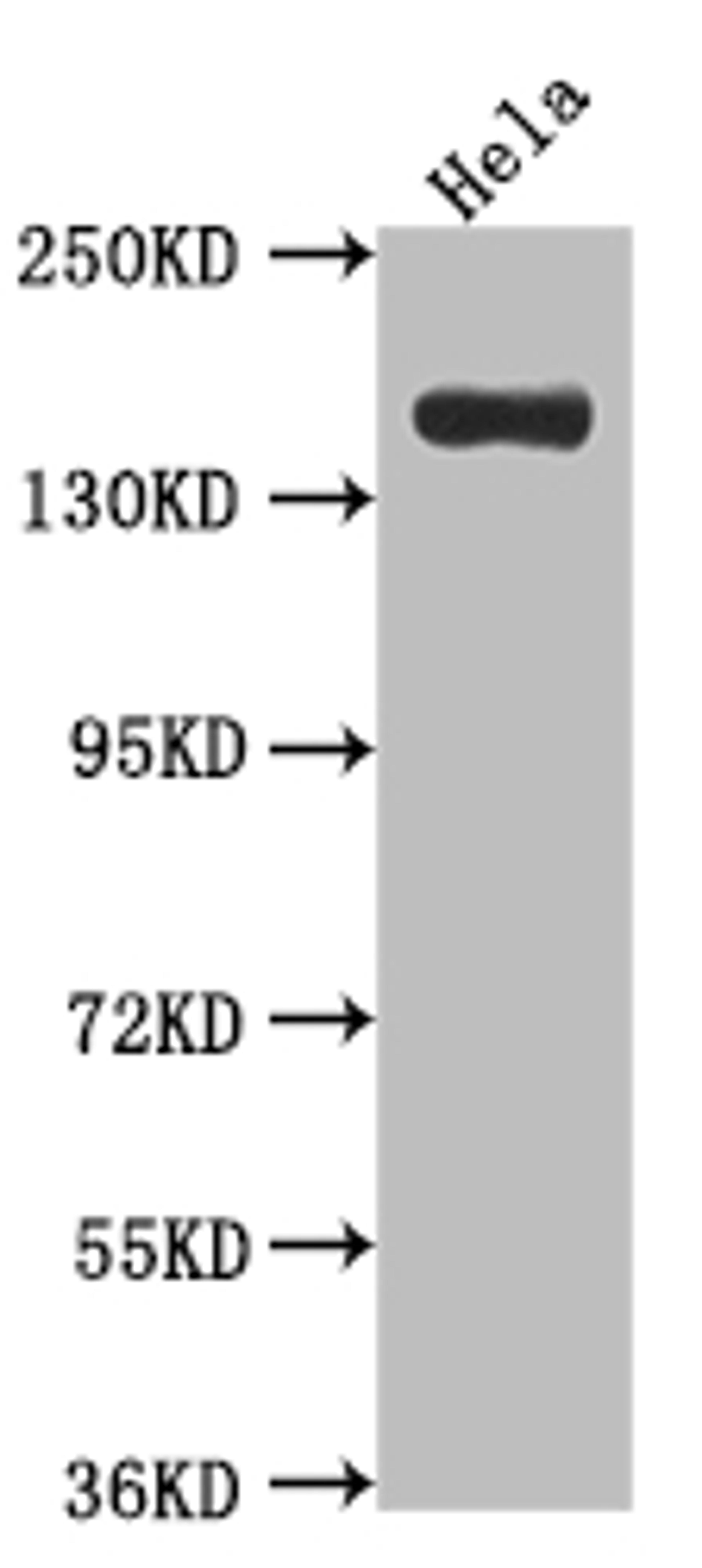 Western Blot. Positive WB detected in: Hela whole cell lysate. All lanes: Xanthine Oxidase antibody at 1:1000. Secondary. Goat polyclonal to rabbit IgG at 1/50000 dilution. Predicted band size: 147 kDa. Observed band size: 147 kDa. 