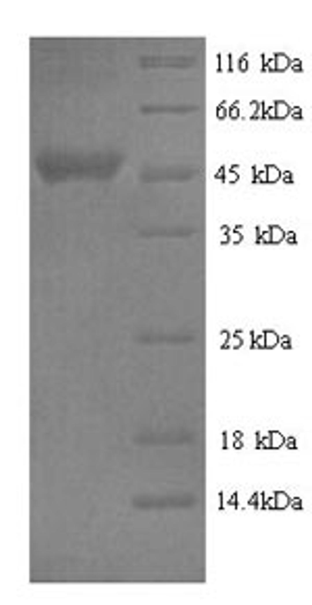 (Tris-Glycine gel) Discontinuous SDS-PAGE (reduced) with 5% enrichment gel and 15% separation gel.