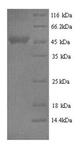 (Tris-Glycine gel) Discontinuous SDS-PAGE (reduced) with 5% enrichment gel and 15% separation gel.