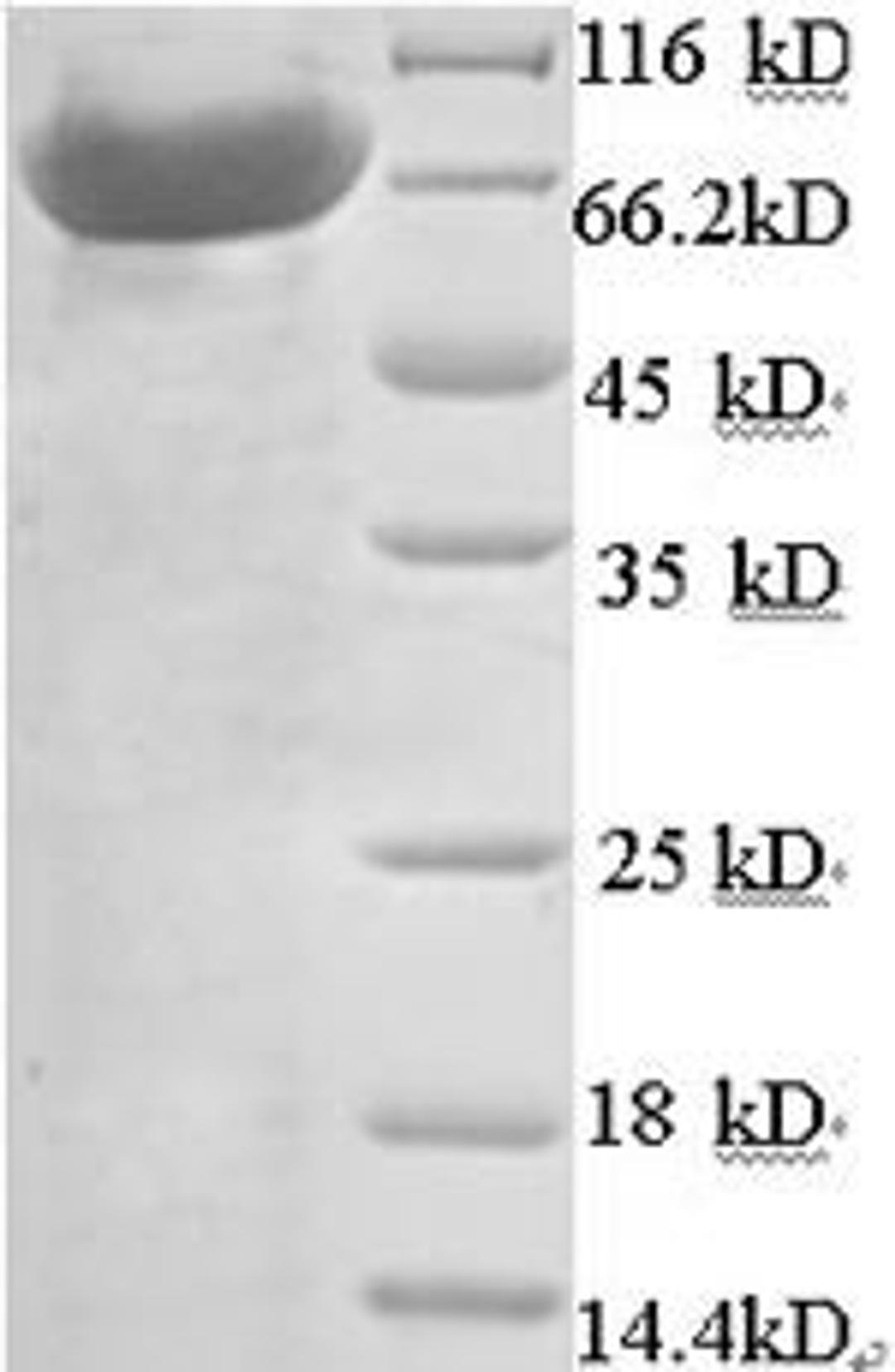 (Tris-Glycine gel) Discontinuous SDS-PAGE (reduced) with 5% enrichment gel and 15% separation gel.
