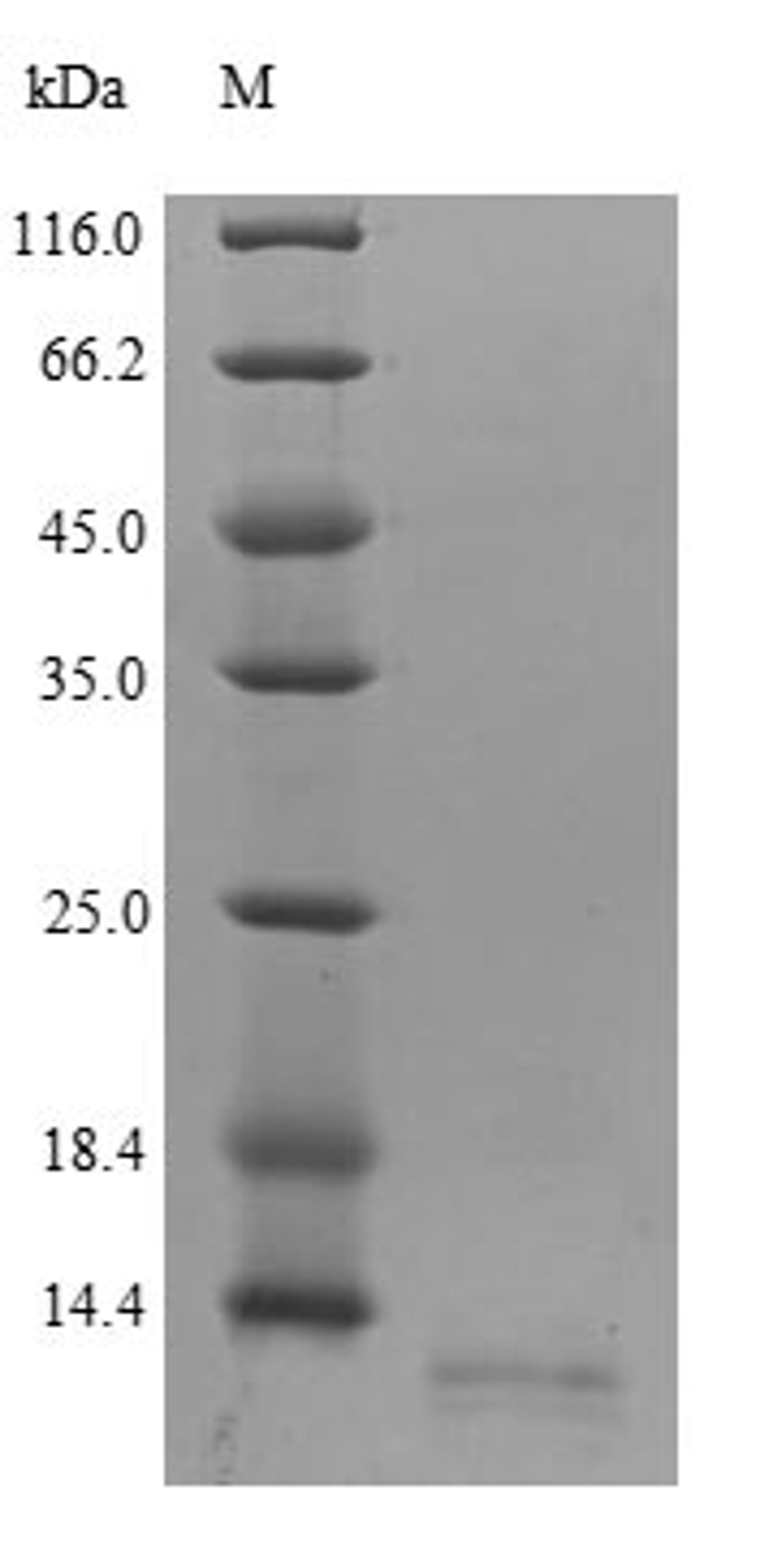 (Tris-Glycine gel) Discontinuous SDS-PAGE (reduced) with 5% enrichment gel and 15% separation gel.