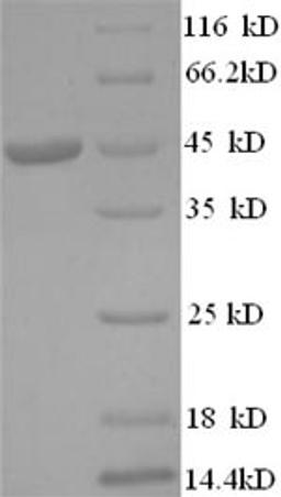 (Tris-Glycine gel) Discontinuous SDS-PAGE (reduced) with 5% enrichment gel and 15% separation gel.