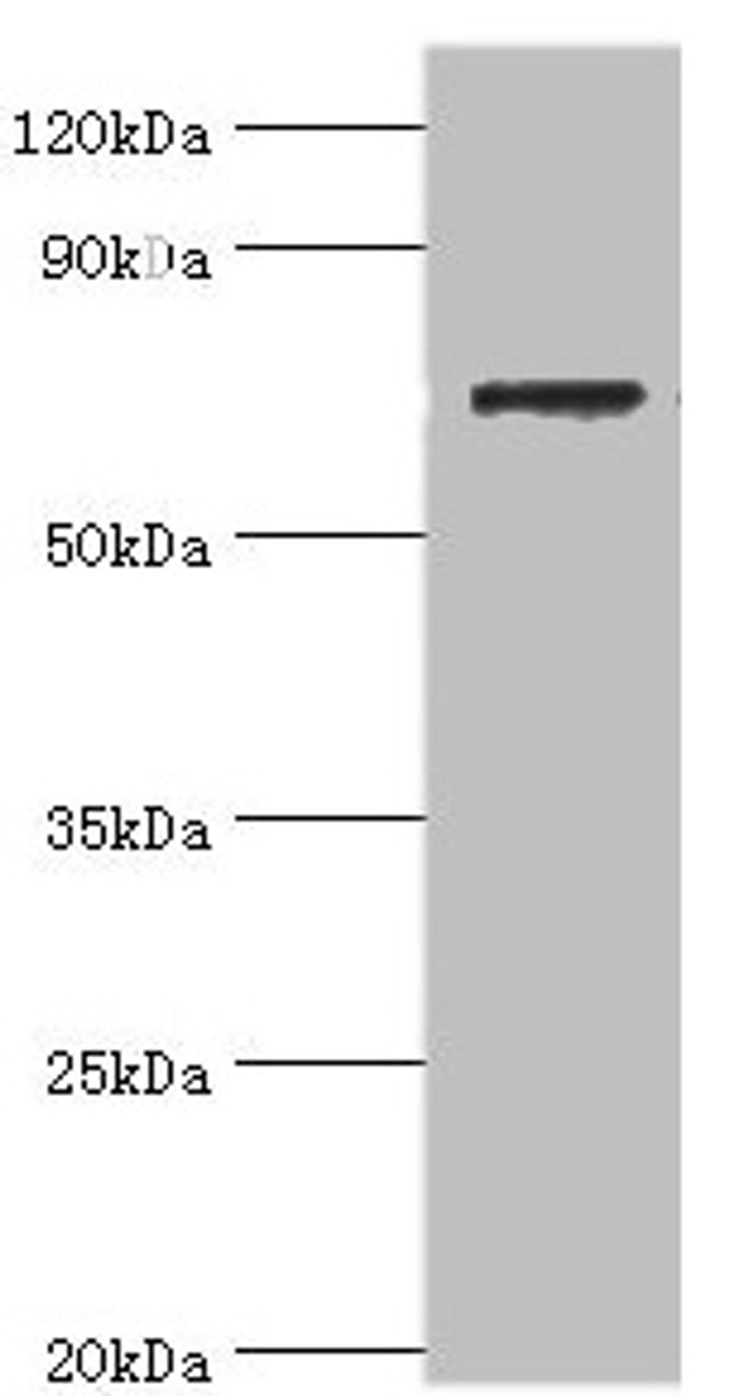 Western blot. All lanes: SLC25A13 antibody at 3µg/ml + HepG2 whole cell lysate. Secondary. Goat polyclonal to rabbit IgG at 1/10000 dilution. Predicted band size: 74 kDa. Observed band size: 74 kDa