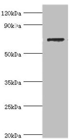 Western blot. All lanes: SLC25A13 antibody at 3µg/ml + HepG2 whole cell lysate. Secondary. Goat polyclonal to rabbit IgG at 1/10000 dilution. Predicted band size: 74 kDa. Observed band size: 74 kDa