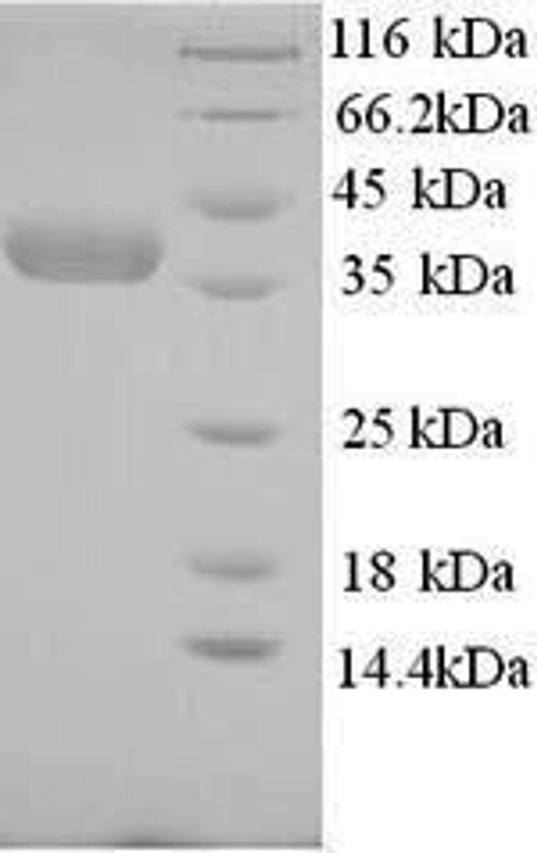 (Tris-Glycine gel) Discontinuous SDS-PAGE (reduced) with 5% enrichment gel and 15% separation gel.