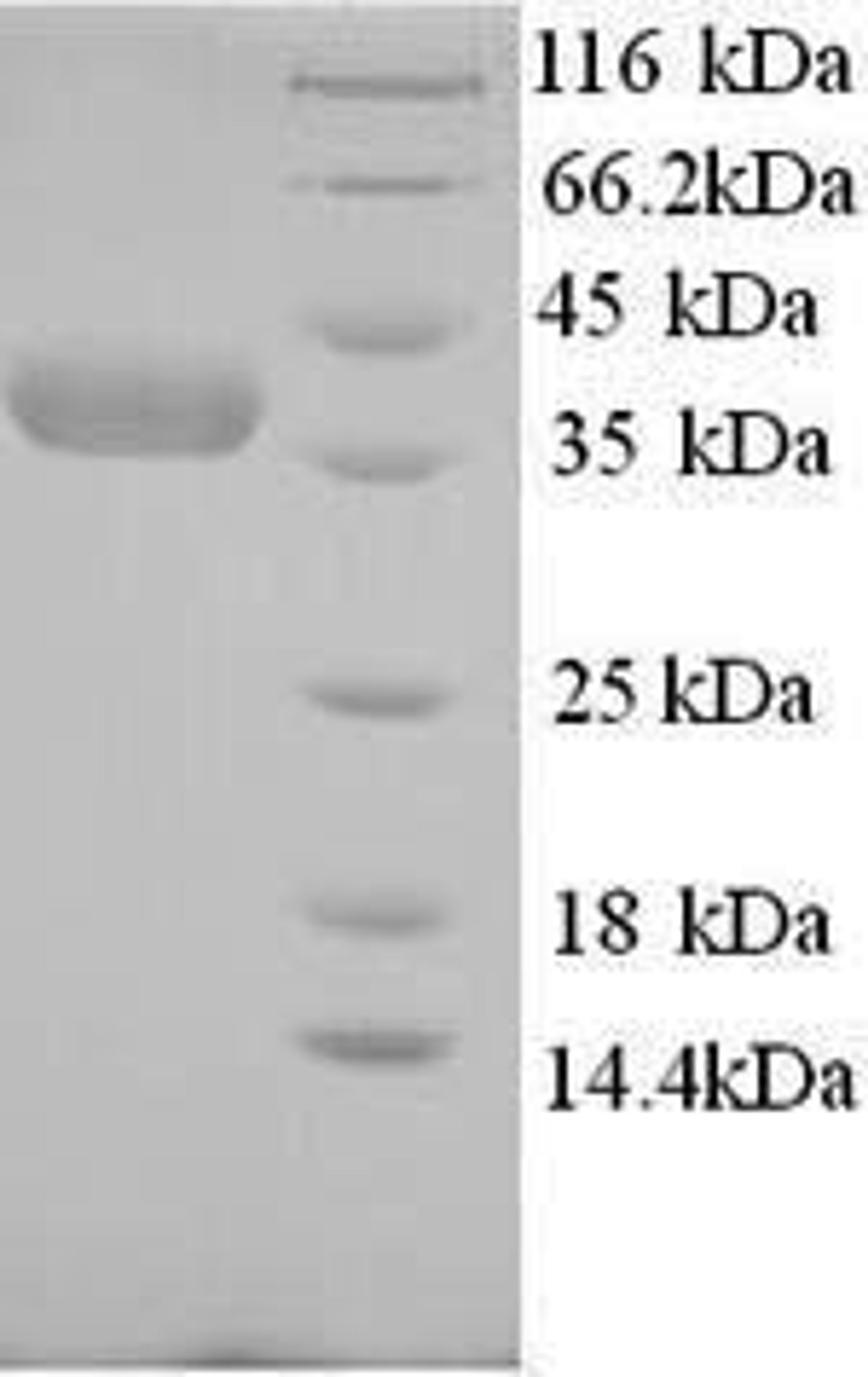 (Tris-Glycine gel) Discontinuous SDS-PAGE (reduced) with 5% enrichment gel and 15% separation gel.