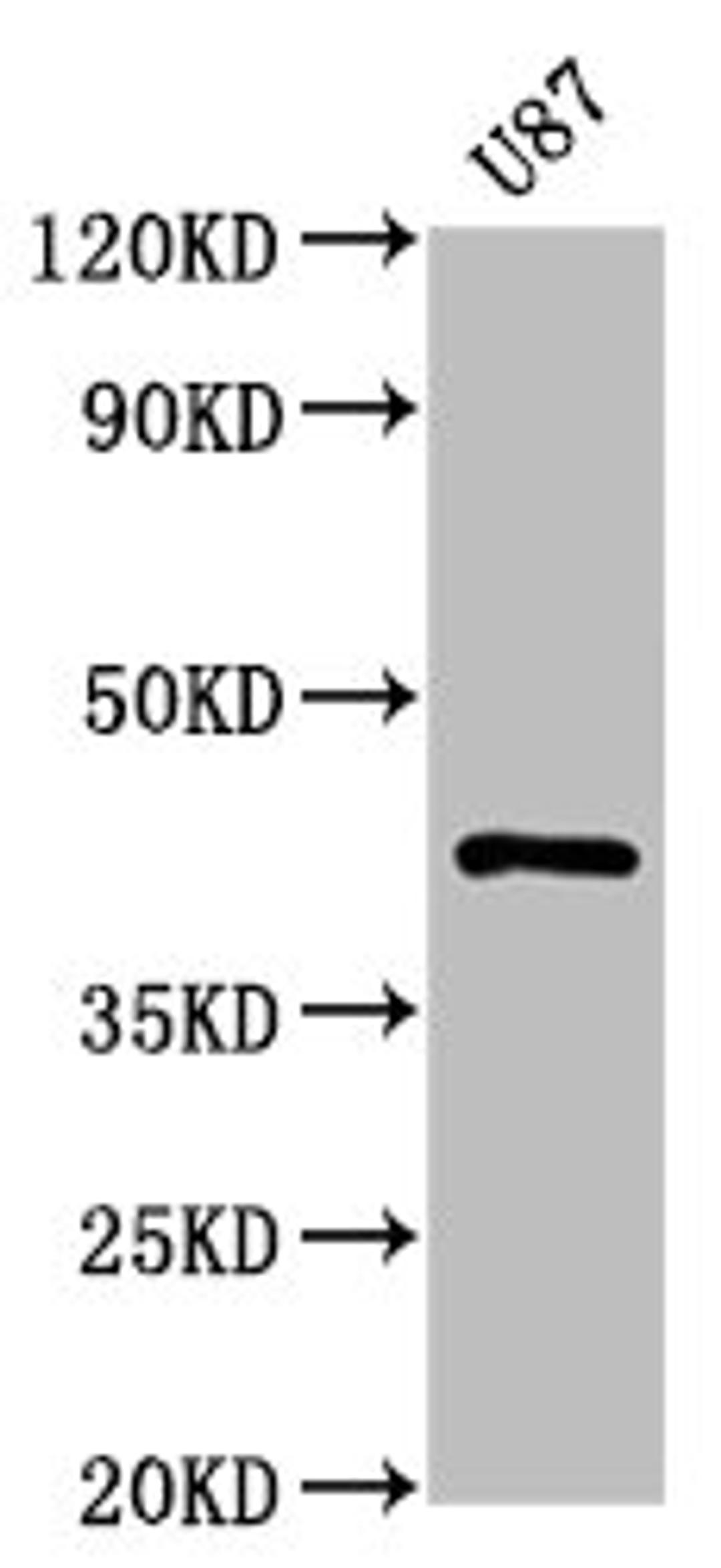 Western Blot. Positive WB detected in: U87 whole cell lysate. All lanes: PRKAR1A antibody at 1.1μg/ml. Secondary. Goat polyclonal to rabbit IgG at 1/50000 dilution. Predicted band size: 43, 39 KDa. Observed band size: 43 KDa. 