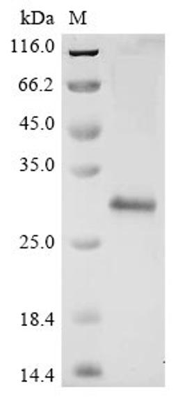 (Tris-Glycine gel) Discontinuous SDS-PAGE (reduced) with 5% enrichment gel and 15% separation gel.