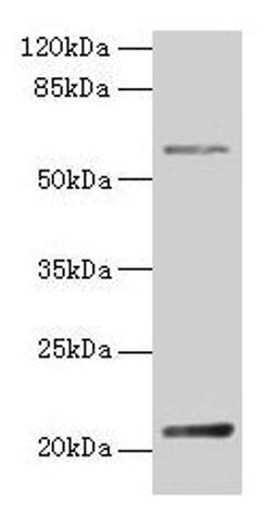 Western blot. All lanes: DUSP13 antibody at 4µg/ml + Hela whole cell lysate. Secondary. Goat polyclonal to rabbit IgG at 1/10000 dilution. Predicted band size: 21, 23, 7, 28, 8, 10, 18 kDa. Observed band size: 21 kDa