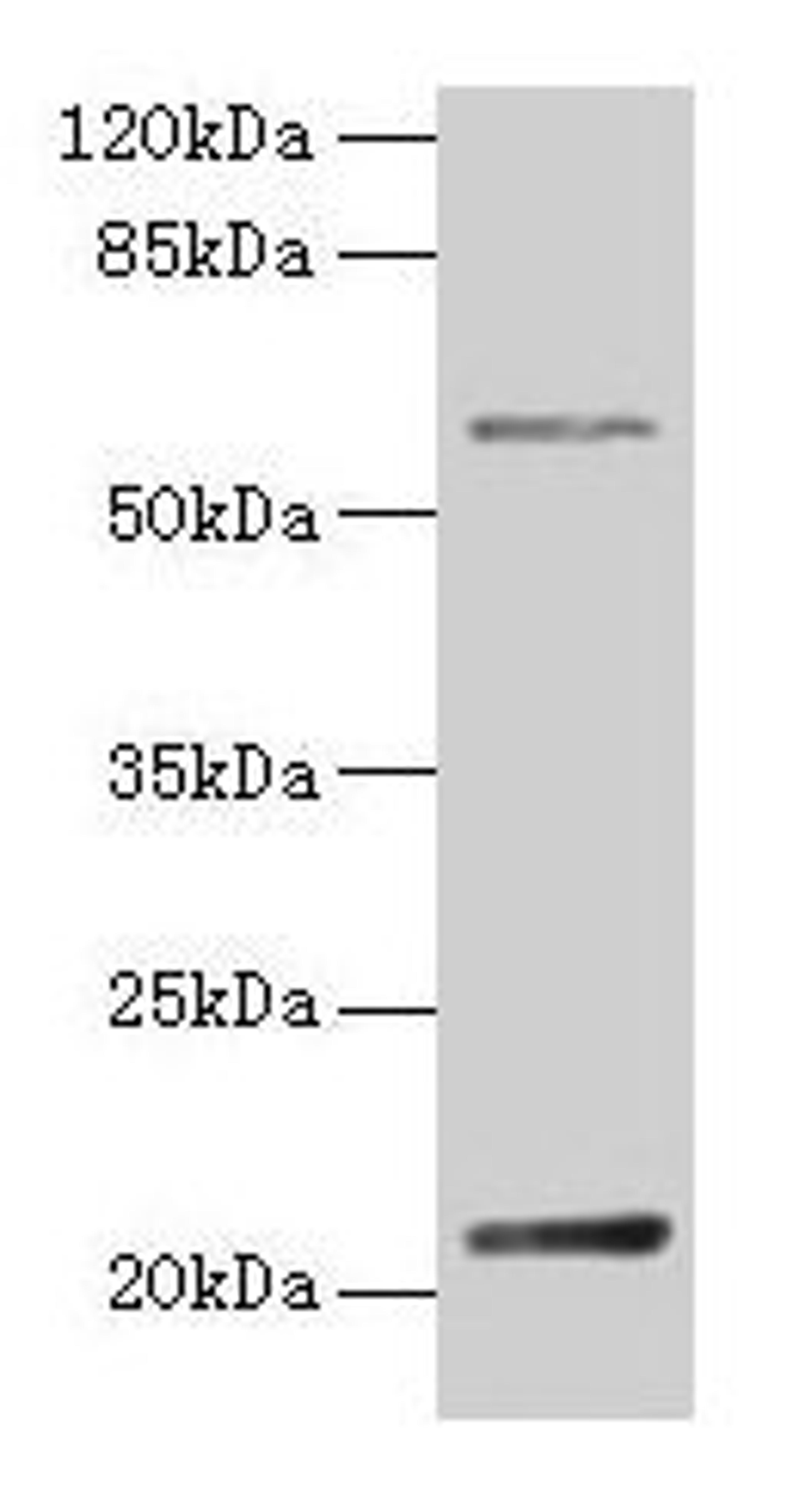 Western blot. All lanes: DUSP13 antibody at 4µg/ml + Hela whole cell lysate. Secondary. Goat polyclonal to rabbit IgG at 1/10000 dilution. Predicted band size: 21, 23, 7, 28, 8, 10, 18 kDa. Observed band size: 21 kDa