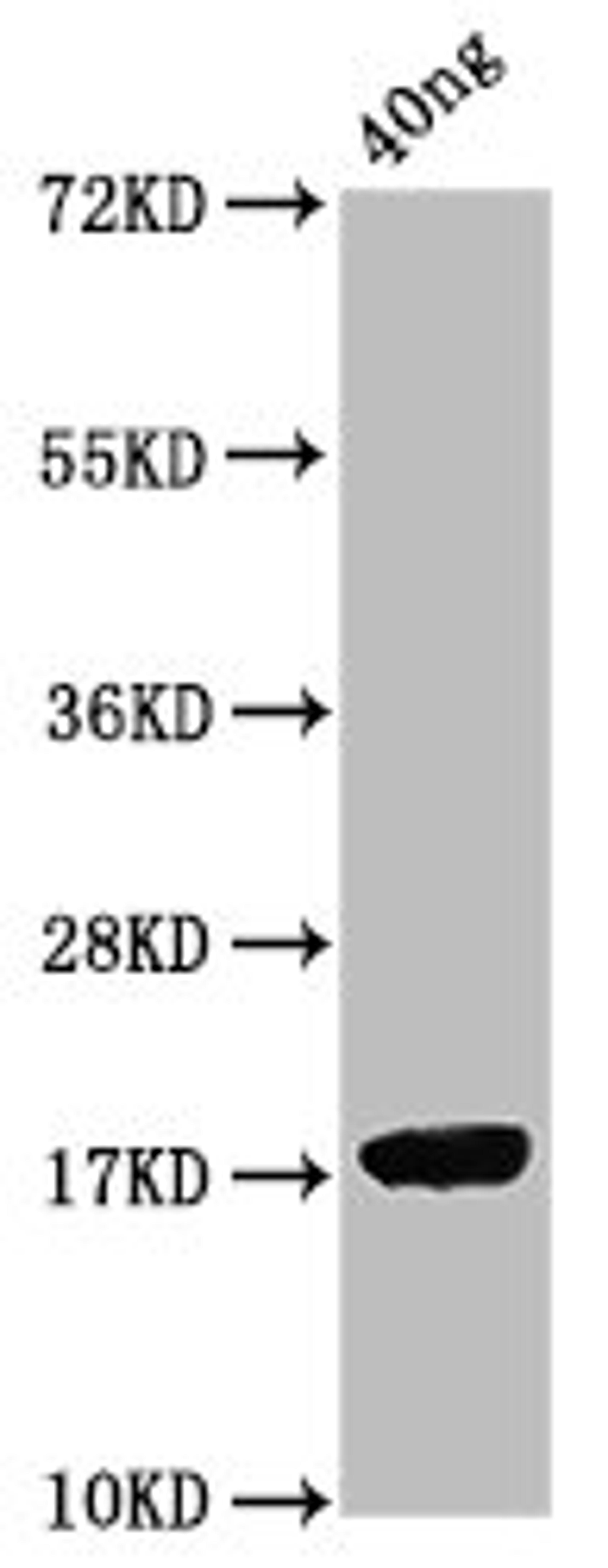 Western Blot. Positive WB detected in Recombinant protein. All lanes: ORF7 antibody at 2.1ug/ml. Secondary. Goat polyclonal to rabbit IgG at 1/50000 dilution. Predicted band size: 18 kDa. Observed band size: 18 kDa. 