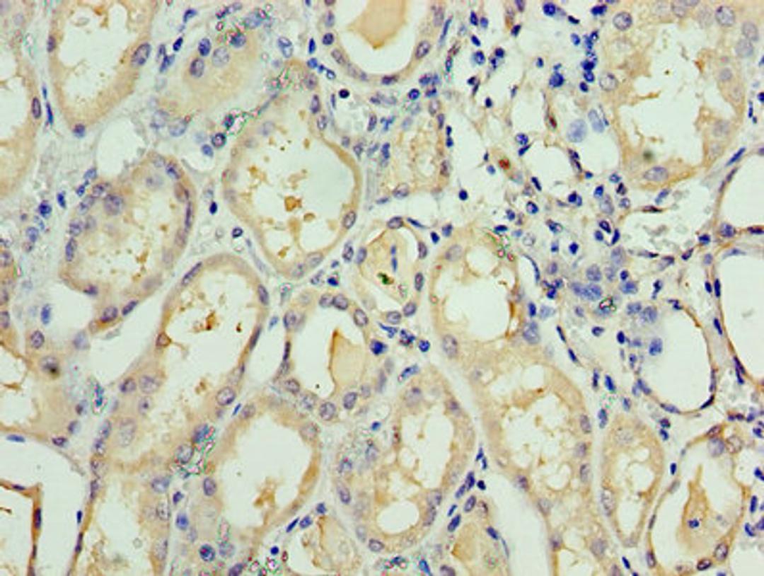Immunohistochemistry of paraffin-embedded human kidney tissue using CSB-PA620884ESR2HU at dilution of 1:100