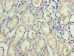Immunohistochemistry of paraffin-embedded human kidney tissue using CSB-PA620884ESR2HU at dilution of 1:100