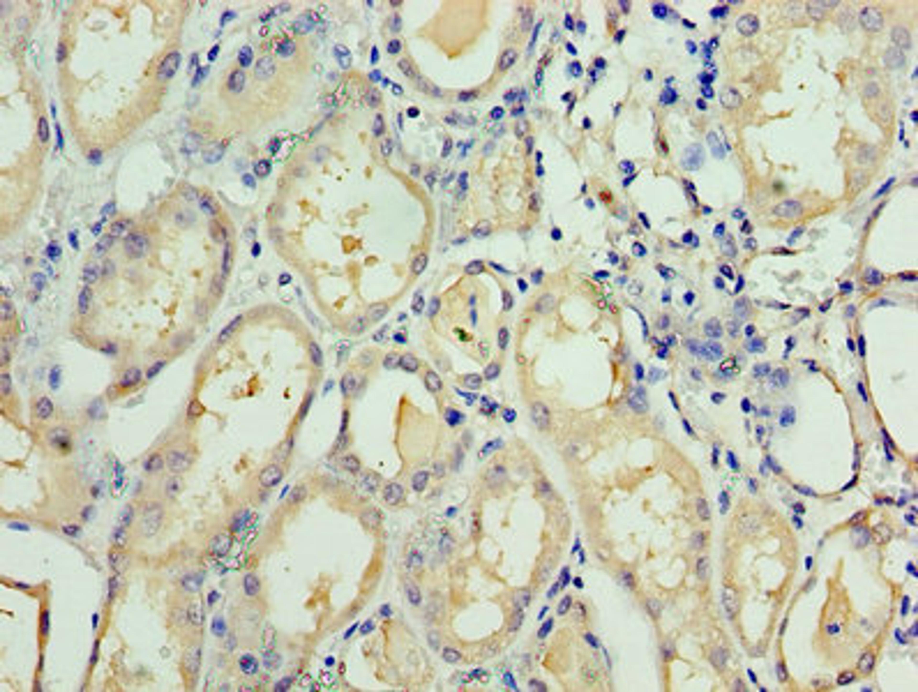 Immunohistochemistry of paraffin-embedded human kidney tissue using CSB-PA620884ESR2HU at dilution of 1:100