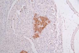 IHC image of CSB-RA582749A0HU diluted at 1:50 and staining in paraffin-embedded human pancreati  tissue performed on a Leica BondTM system. After dewaxing and hydration, antigen retrieval was mediated by high pressure in a citrate buffer (pH 6.0). Section was blocked with 10% normal goat serum 30min at RT. Then primary antibody (1% BSA) was incubated at 4°C overnight. The primary is detected by a Goat anti-rabbit polymer IgG labeled by HRP and visualized using 0.34% DAB.