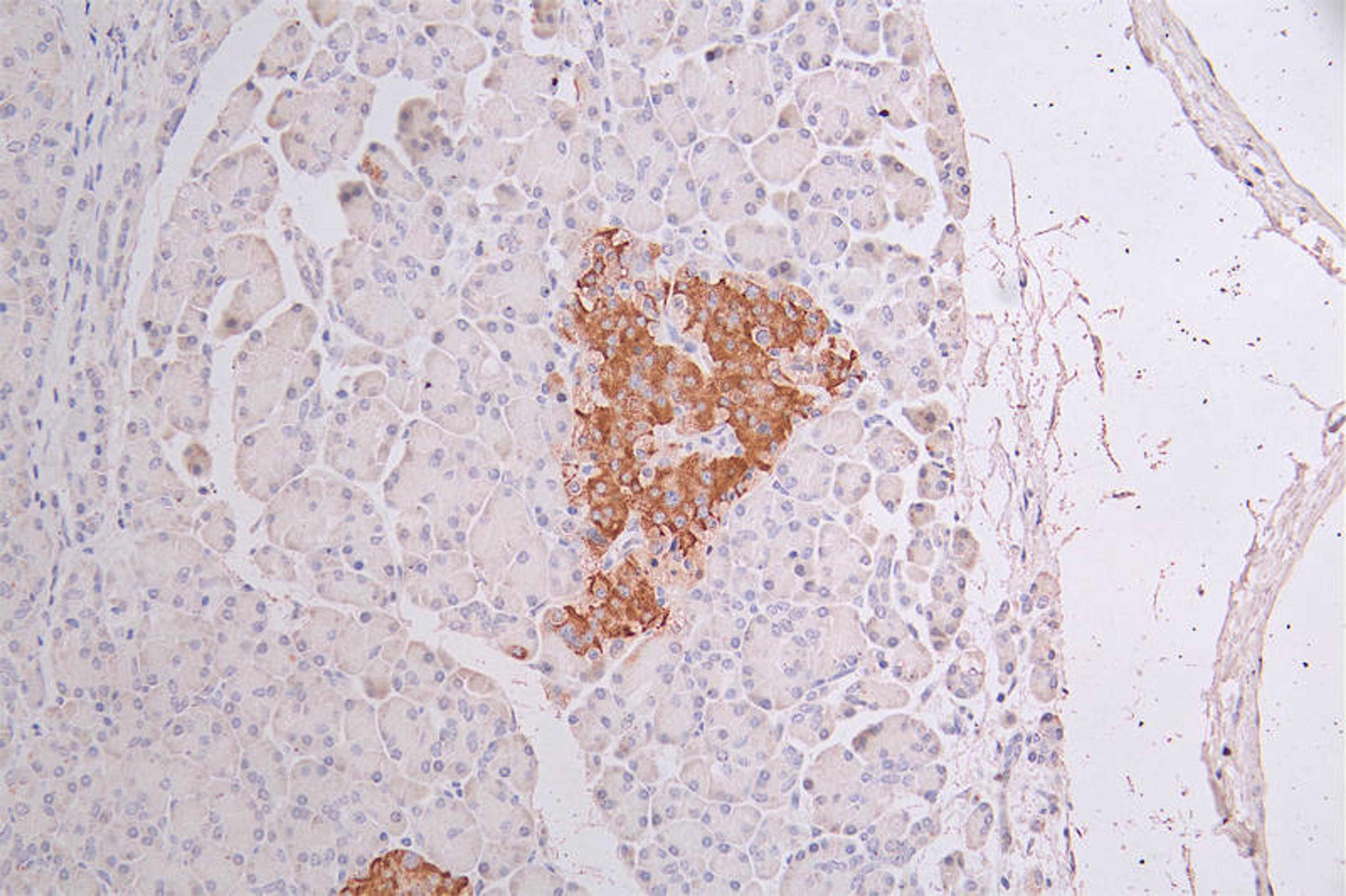 IHC image of CSB-RA582749A0HU diluted at 1:50 and staining in paraffin-embedded human pancreati tissue performed on a Leica BondTM system. After dewaxing and hydration, antigen retrieval was mediated by high pressure in a citrate buffer (pH 6.0). Section was blocked with 10% normal goat serum 30min at RT. Then primary antibody (1% BSA) was incubated at 4°C overnight. The primary is detected by a Goat anti-rabbit polymer IgG labeled by HRP and visualized using 0.34% DAB.