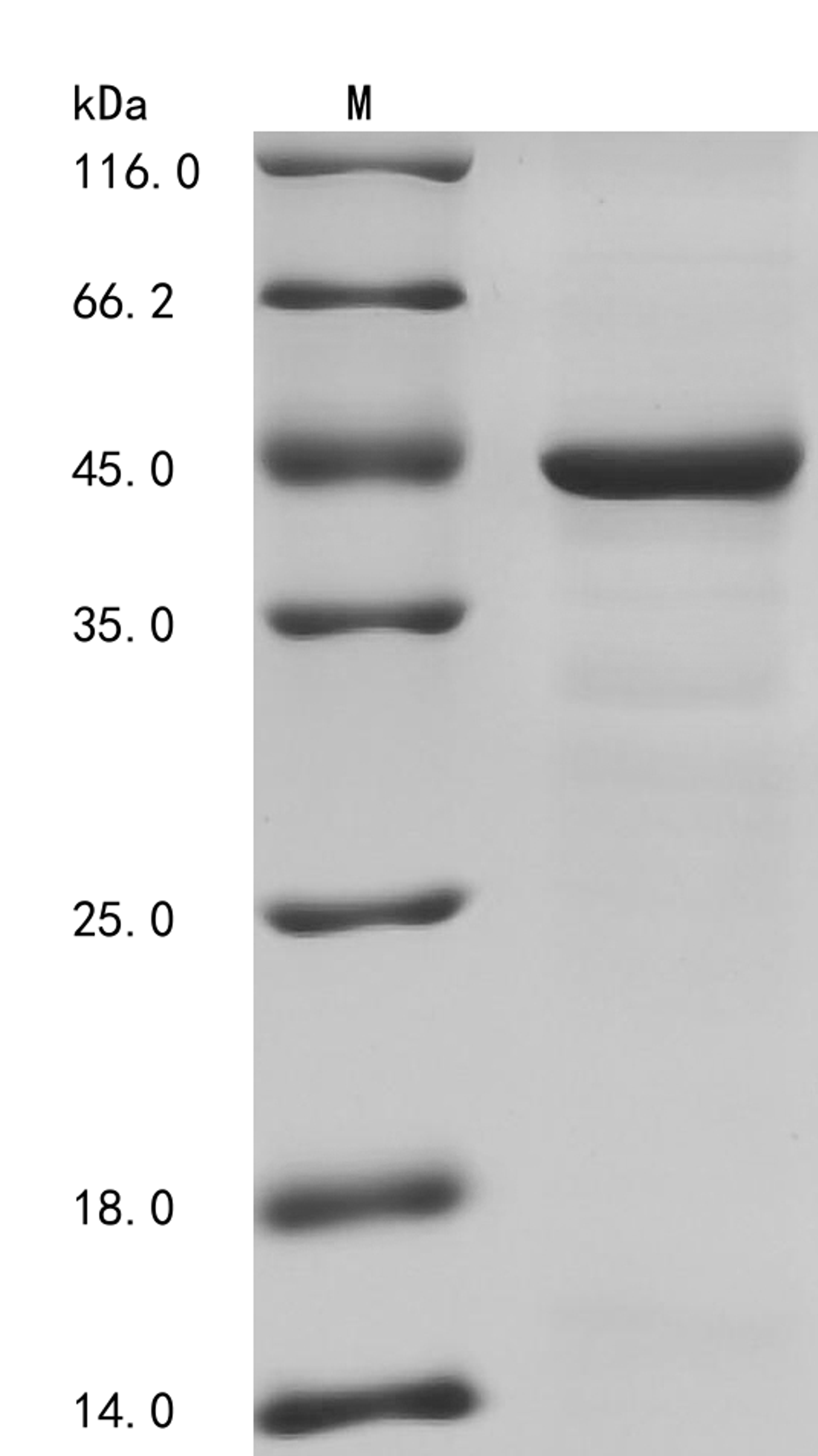 (Tris-Glycine gel) Discontinuous SDS-PAGE (reduced) with 5% enrichment gel and 15% separation gel.