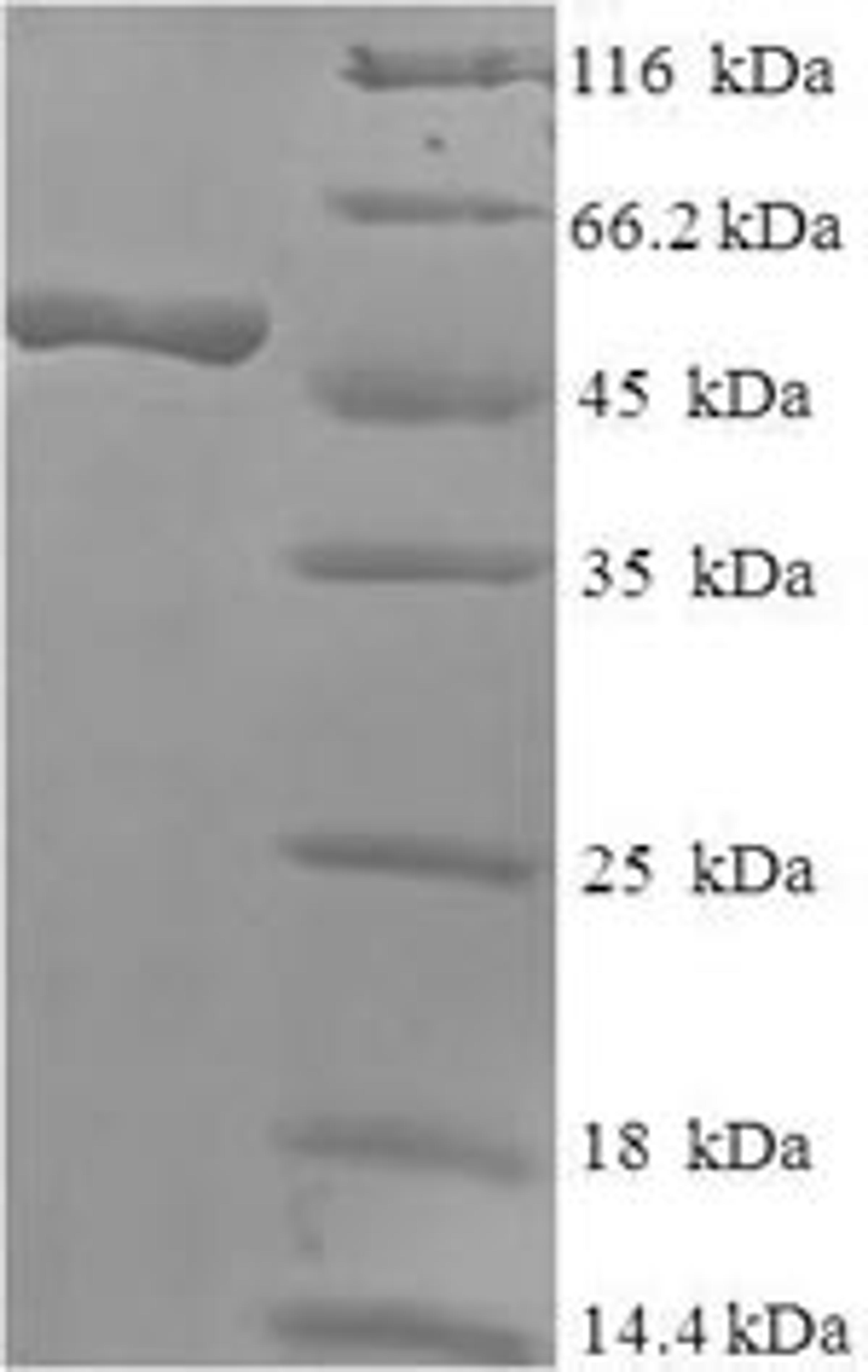 (Tris-Glycine gel) Discontinuous SDS-PAGE (reduced) with 5% enrichment gel and 15% separation gel.