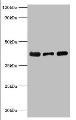 Western blot. All lanes: Alpha-2, 8-sialyltransferase 8B antibody at 8ug/ml. Lane 1: Mouse heart tissue. Lane 2: HepG2 whole cell lysate. Lane 3: Mouse kidney tissue. Secondary. Goat polyclonal to rabbit IgG at 1/10000 dilution. Predicted band size: 42 kDa. Observed band size: 42 kDa.