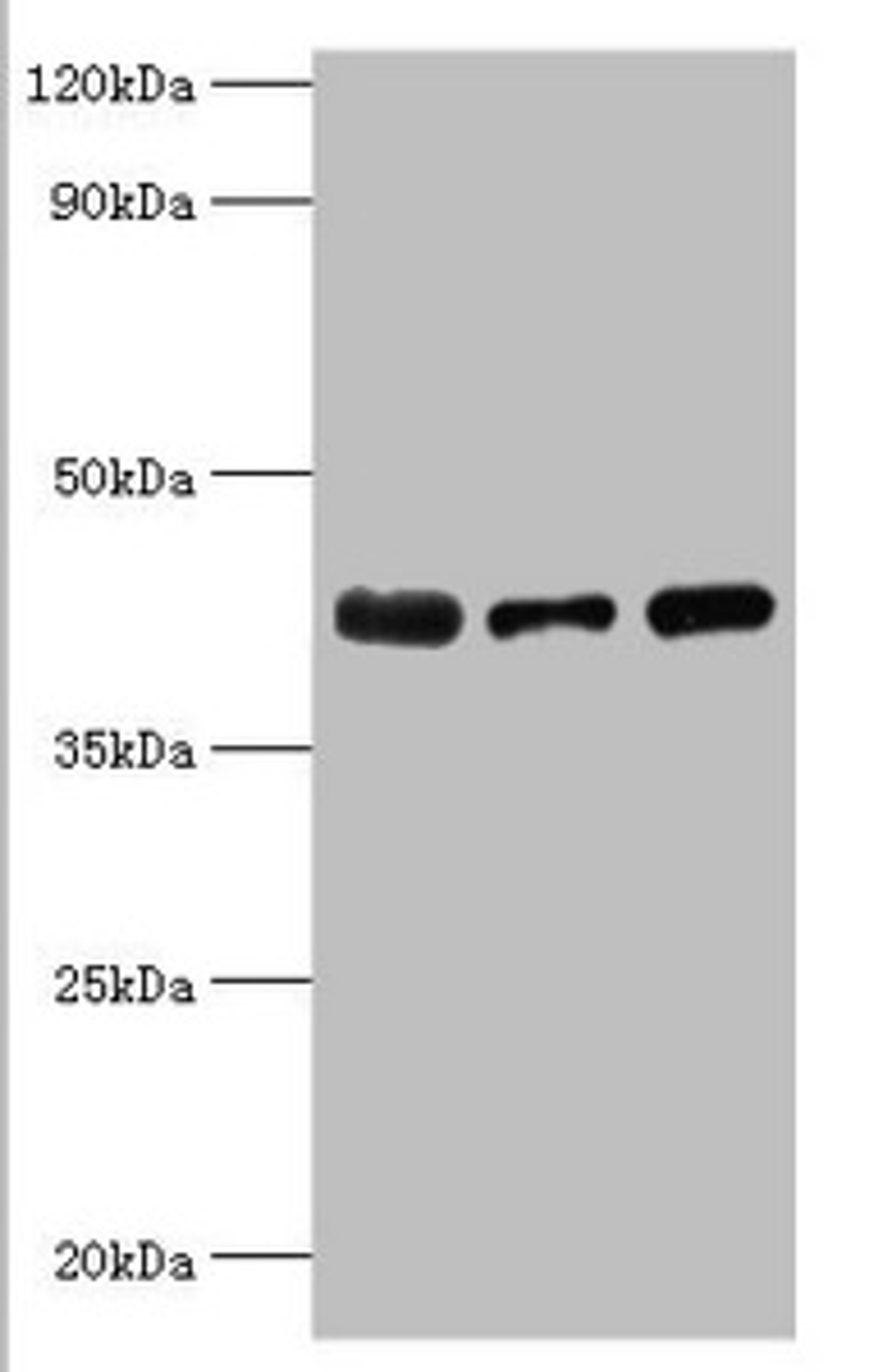 Western blot. All lanes: Alpha-2, 8-sialyltransferase 8B antibody at 8ug/ml. Lane 1: Mouse heart tissue. Lane 2: HepG2 whole cell lysate. Lane 3: Mouse kidney tissue. Secondary. Goat polyclonal to rabbit IgG at 1/10000 dilution. Predicted band size: 42 kDa. Observed band size: 42 kDa.