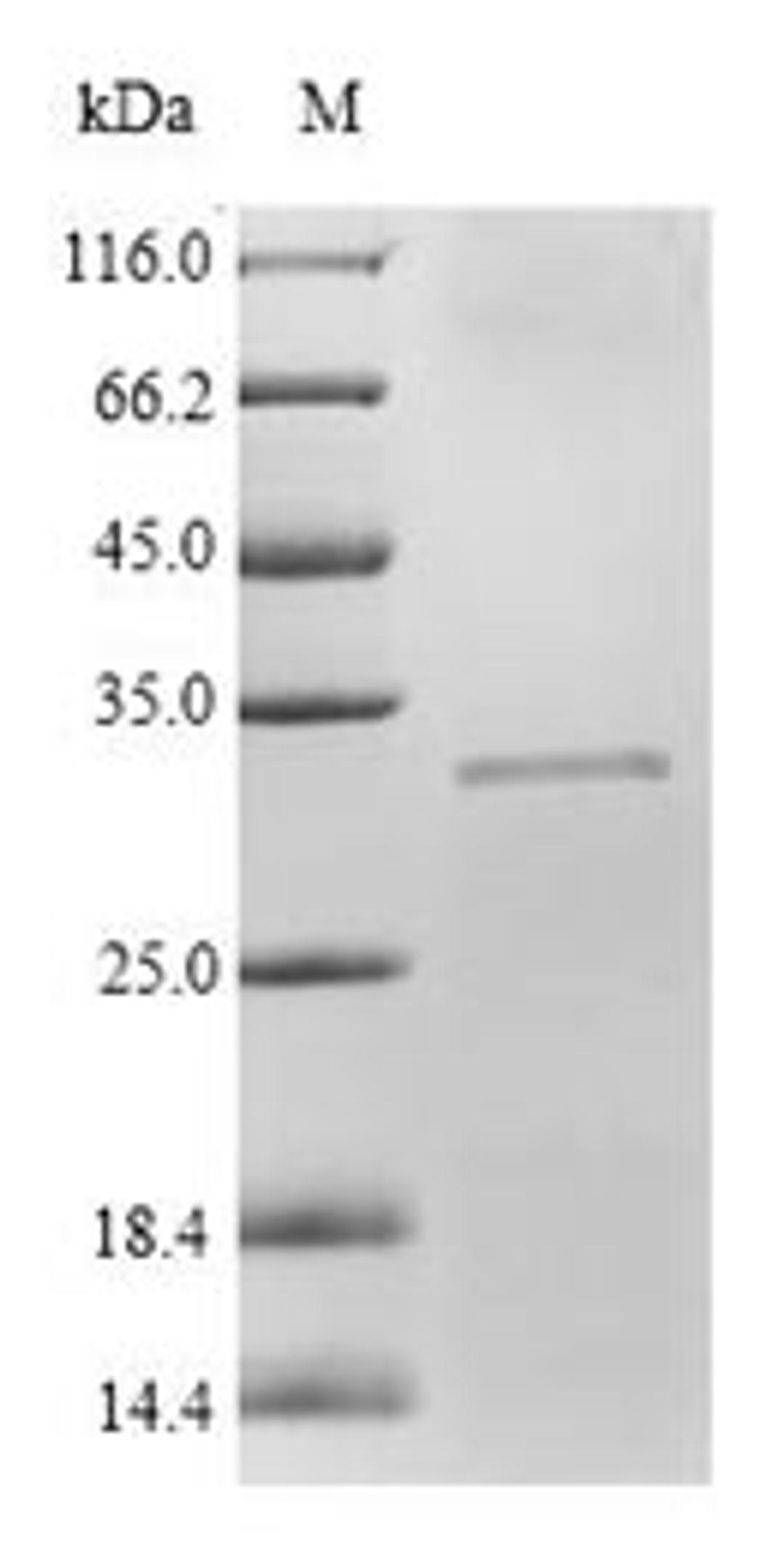 (Tris-Glycine gel) Discontinuous SDS-PAGE (reduced) with 5% enrichment gel and 15% separation gel.