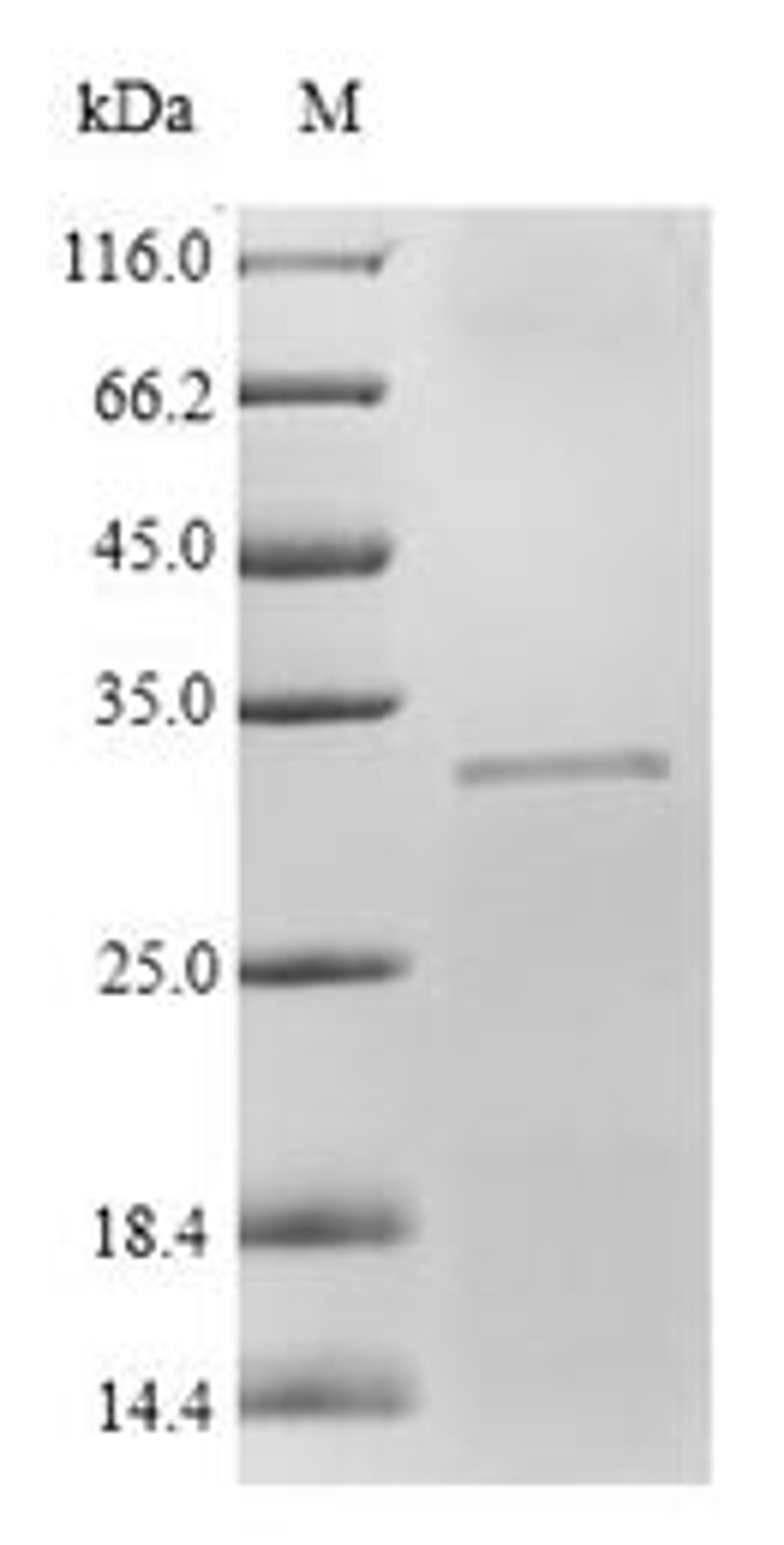 (Tris-Glycine gel) Discontinuous SDS-PAGE (reduced) with 5% enrichment gel and 15% separation gel.