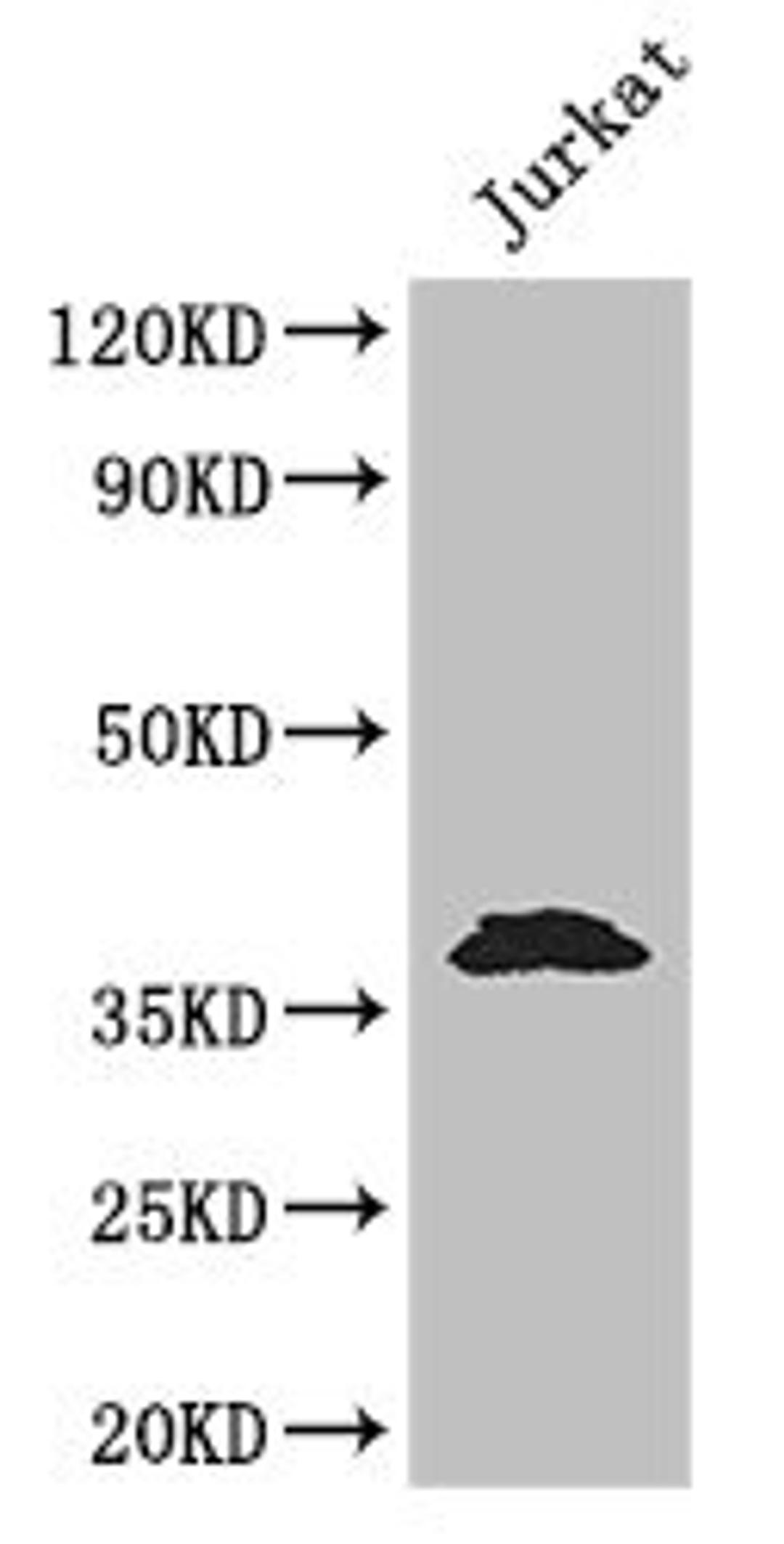 Western Blot. Positive WB detected in: Jurkat whole cell lysate. All lanes: MCL1 antibody at 3.2ug/ml. Secondary. Goat polyclonal to rabbit IgG at 1/50000 dilution. Predicted band size: 38, 29 kDa. Observed band size: 38 kDa. 