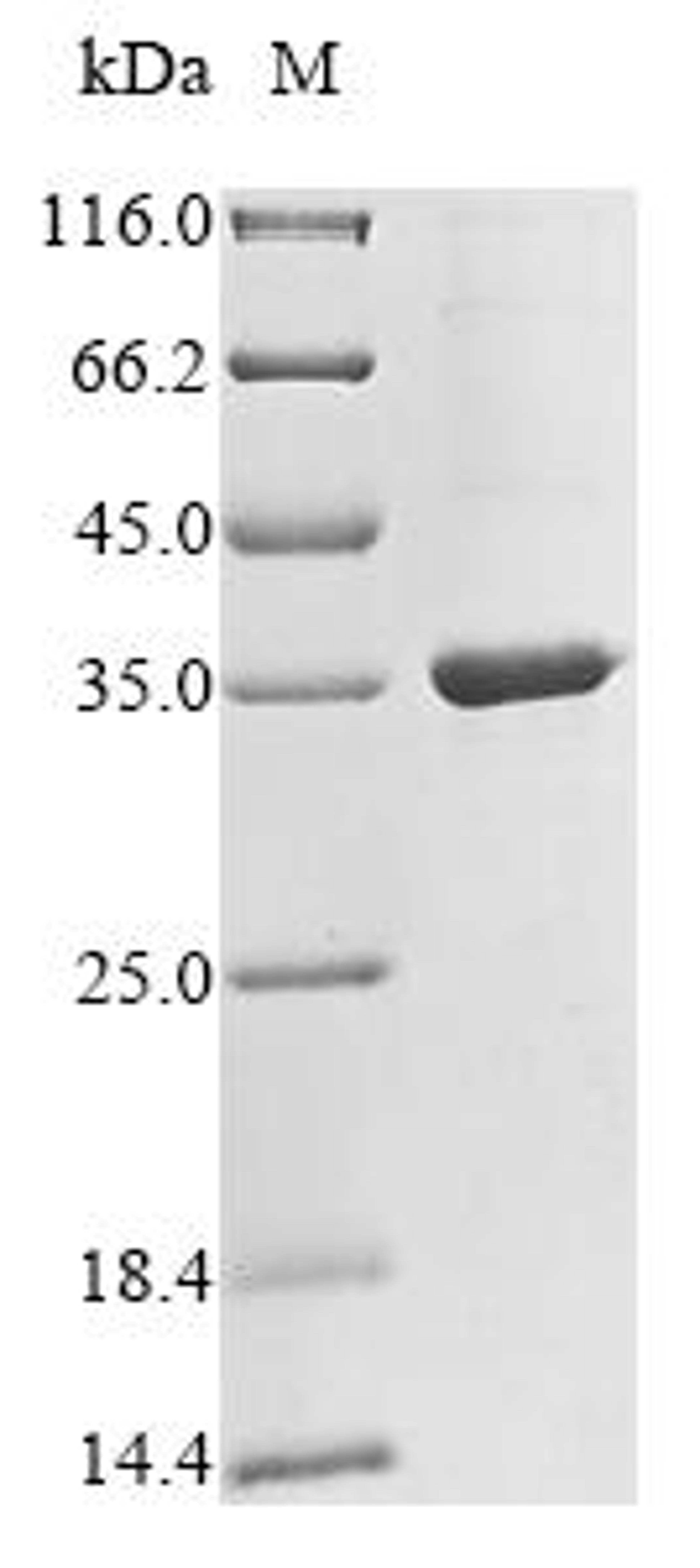 (Tris-Glycine gel) Discontinuous SDS-PAGE (reduced) with 5% enrichment gel and 15% separation gel.