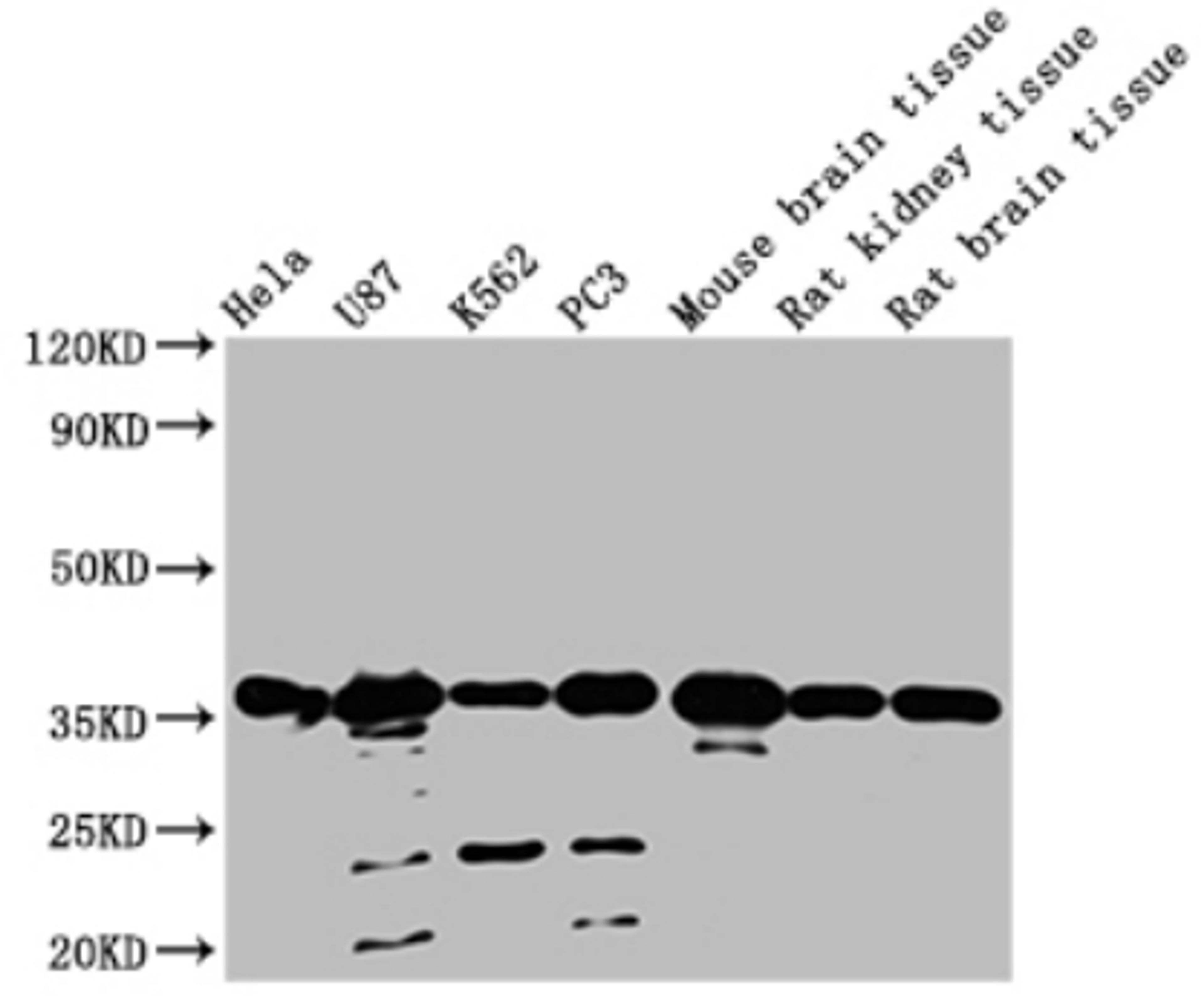 Western Blot. Positive WB detected in: Hela whole cell lysate, U87 whole cell lysate, K562 whole cell lysate, PC3 whole cell lysate, Mouse brain tissue, Rat kidney tissue, Rat brain tissue. All lanes: METRNL antibody at 1:2000. Secondary. Goat polyclonal to rabbit IgG at 1/50000 dilution. Predicted band size: 35, 26 KDa. Observed band size: 35 KDa. Exposure time:1min.