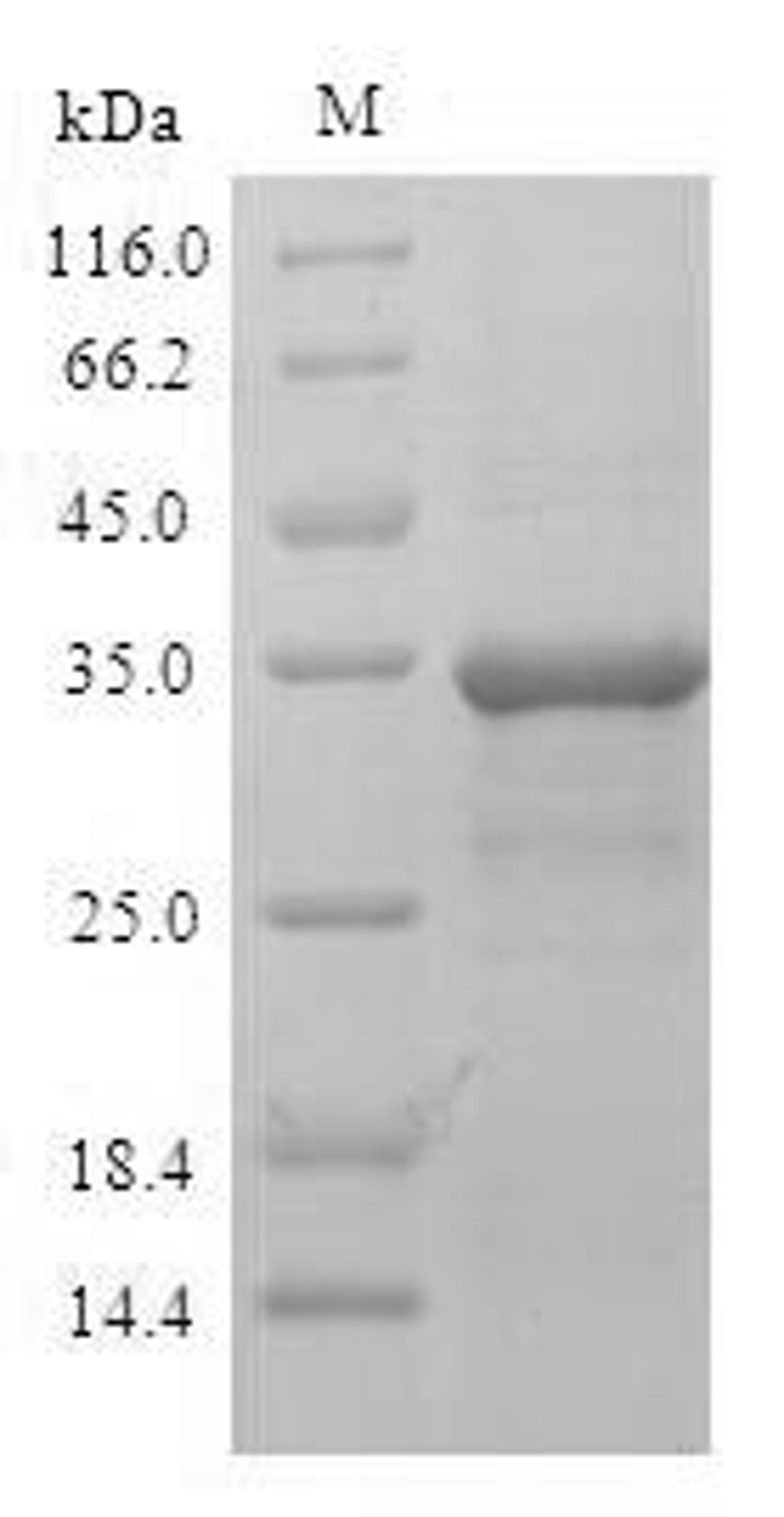 (Tris-Glycine gel) Discontinuous SDS-PAGE (reduced) with 5% enrichment gel and 15% separation gel.