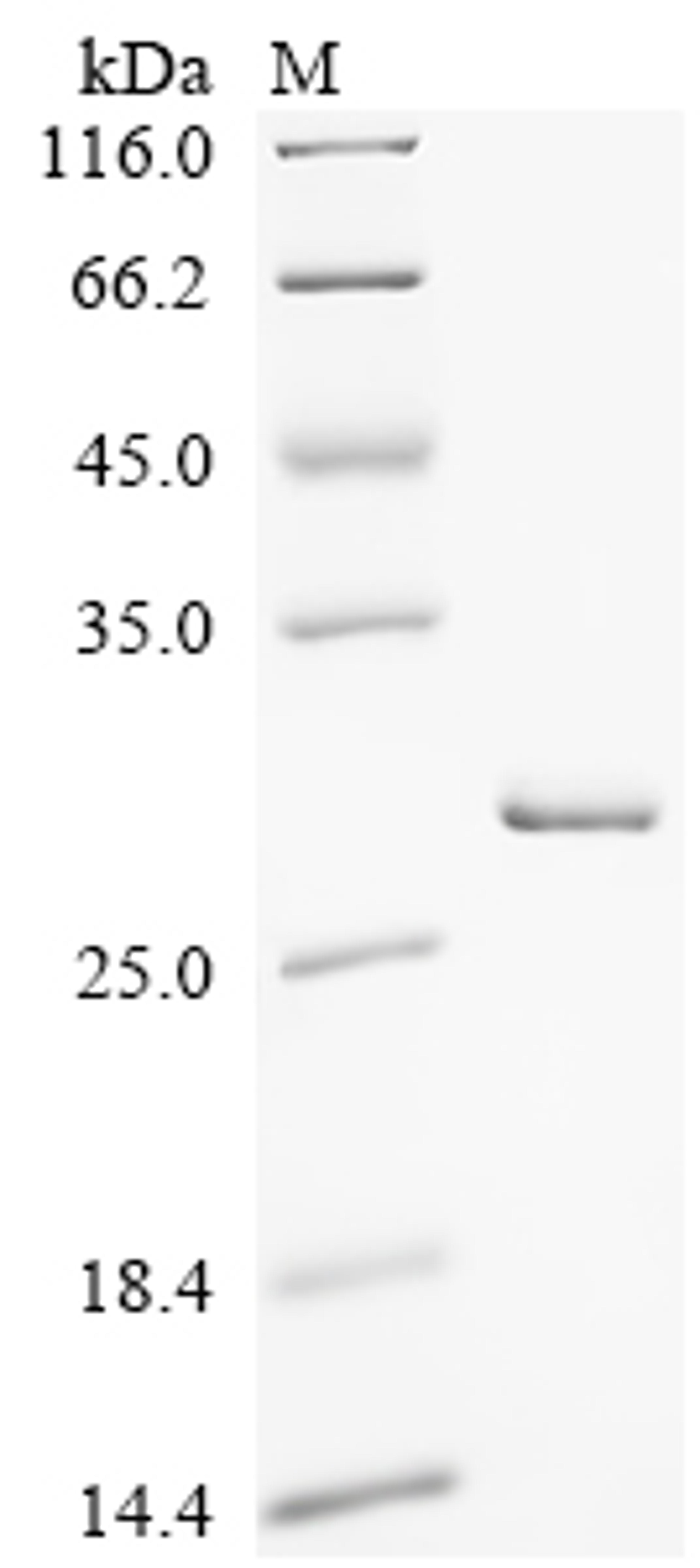 (Tris-Glycine gel) Discontinuous SDS-PAGE (reduced) with 5% enrichment gel and 15% separation gel.