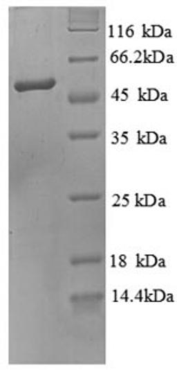 (Tris-Glycine gel) Discontinuous SDS-PAGE (reduced) with 5% enrichment gel and 15% separation gel.