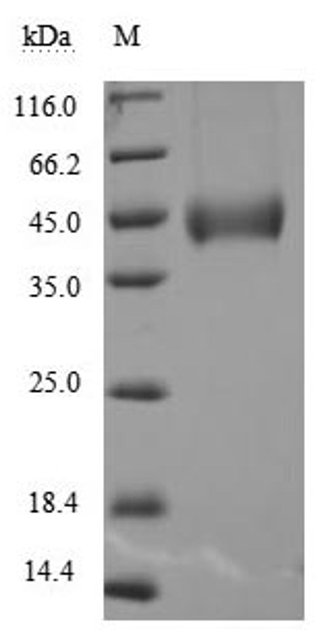 (Tris-Glycine gel) Discontinuous SDS-PAGE (reduced) with 5% enrichment gel and 15% separation gel.