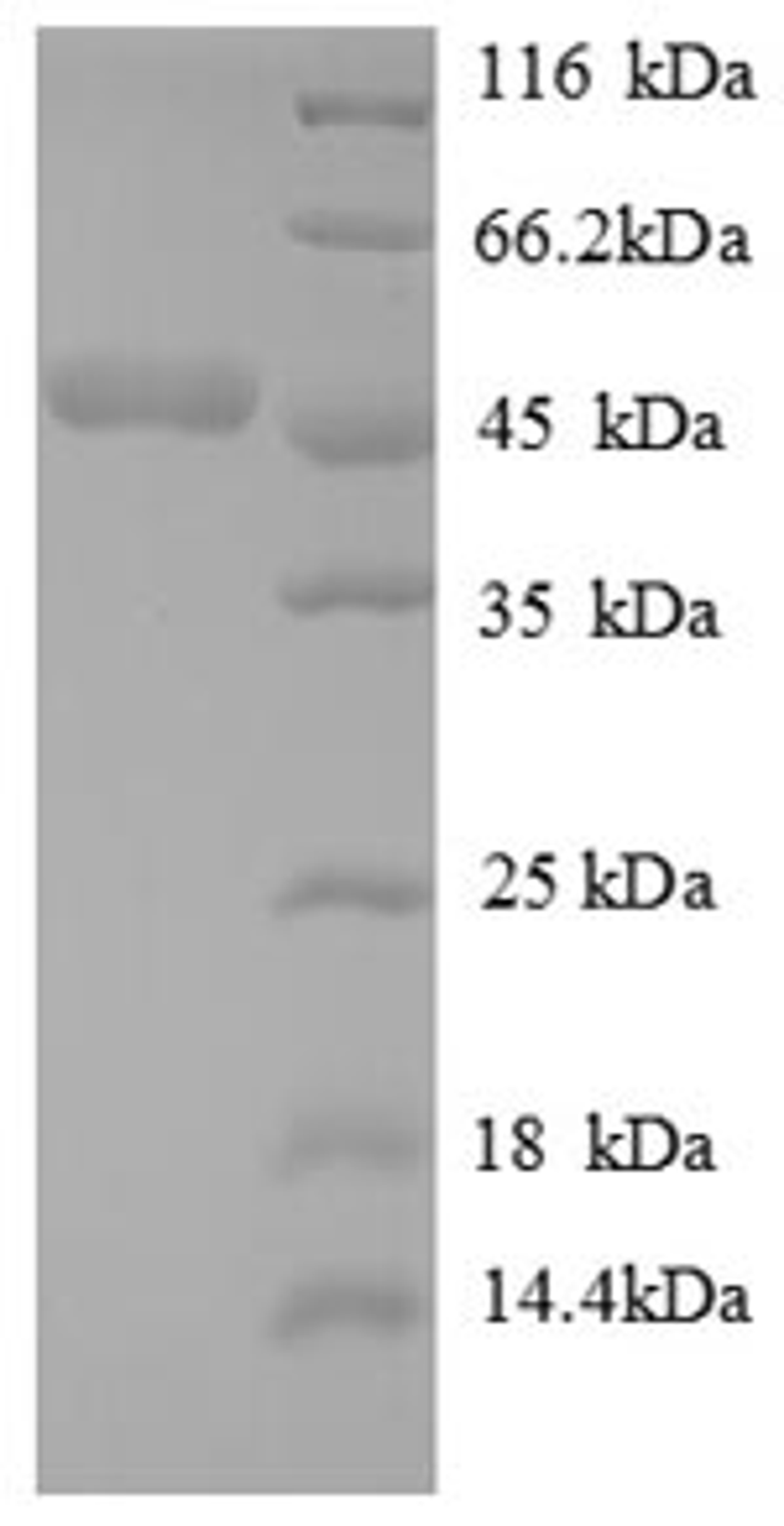 (Tris-Glycine gel) Discontinuous SDS-PAGE (reduced) with 5% enrichment gel and 15% separation gel.