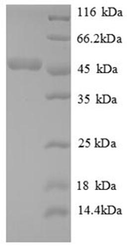 (Tris-Glycine gel) Discontinuous SDS-PAGE (reduced) with 5% enrichment gel and 15% separation gel.