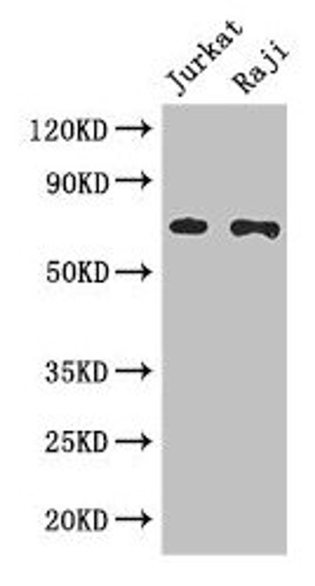 Western Blot. Positive WB detected in: Jurkat whole cell lysate, Raji whole cell lysate. All lanes: CDC25B antibody at 3µg/ml. Secondary. Goat polyclonal to rabbit IgG at 1/50000 dilution. Predicted band size: 65, 64, 61, 68 kDa. Observed band size: 65 kDa