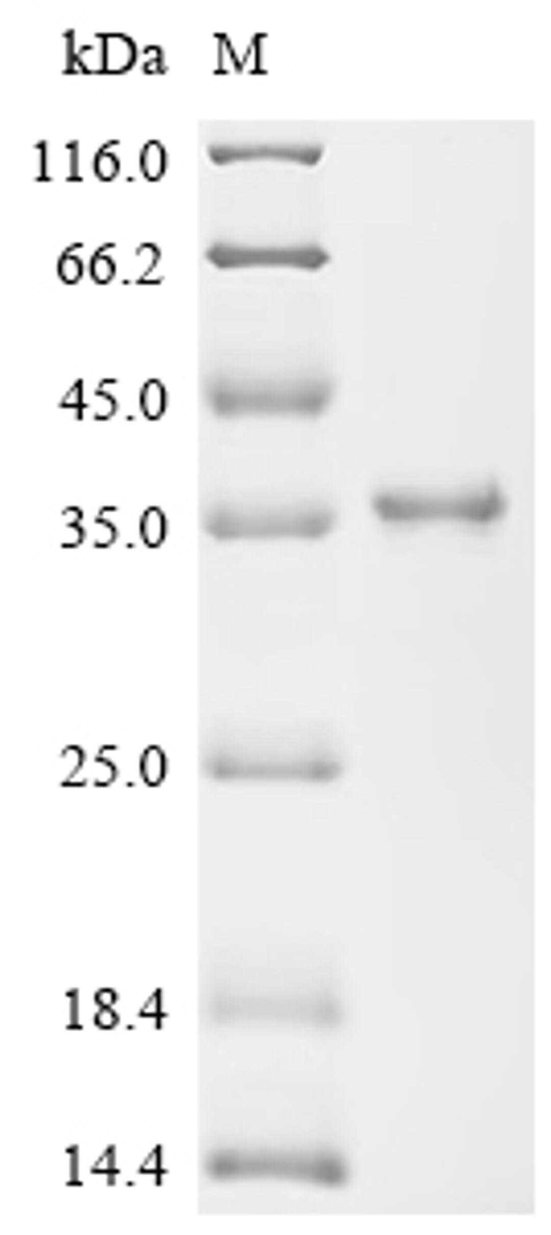 (Tris-Glycine gel) Discontinuous SDS-PAGE (reduced) with 5% enrichment gel and 15% separation gel.