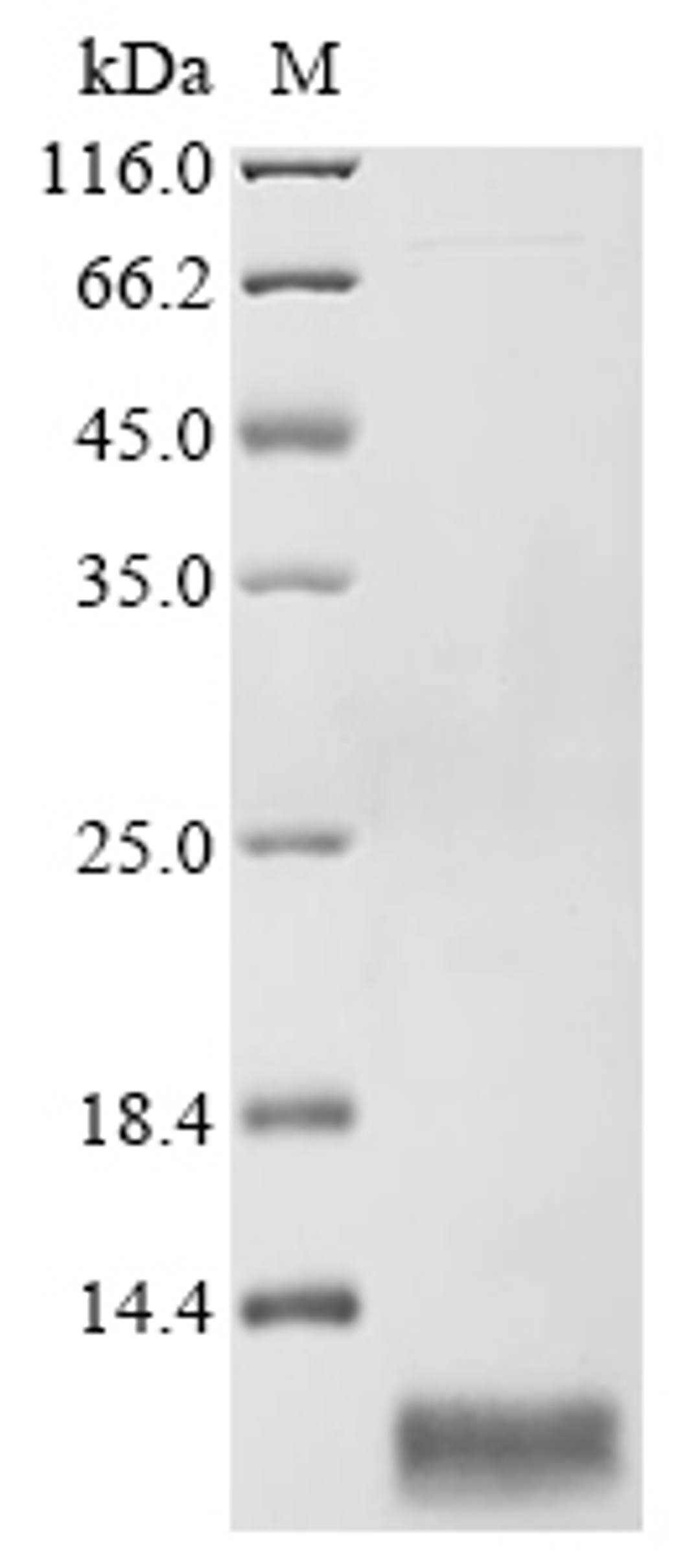 (Tris-Glycine gel) Discontinuous SDS-PAGE (reduced) with 5% enrichment gel and 15% separation gel.