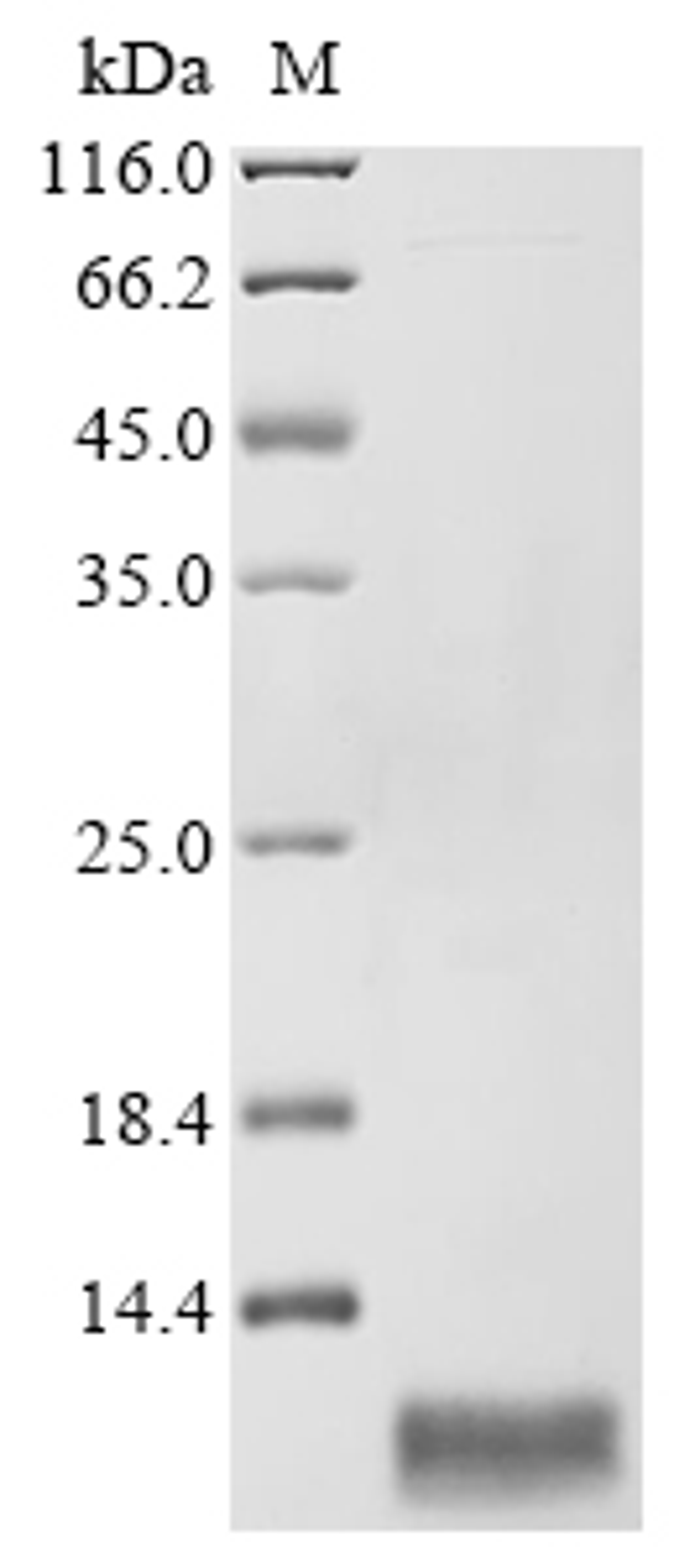 (Tris-Glycine gel) Discontinuous SDS-PAGE (reduced) with 5% enrichment gel and 15% separation gel.