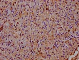 IHC image of CSB-PA873641LA01HU diluted at 1:400 and staining in paraffin-embedded human pancreatic tissue performed on a Leica BondTM system. After dewaxing and hydration, antigen retrieval was mediated by high pressure in a citrate buffer (pH 6.0). Section was blocked with 10% normal goat serum 30min at RT. Then primary antibody (1% BSA) was incubated at 4&deg;C overnight. The primary is detected by a biotinylated secondary antibody and visualized using an HRP conjugated SP system.