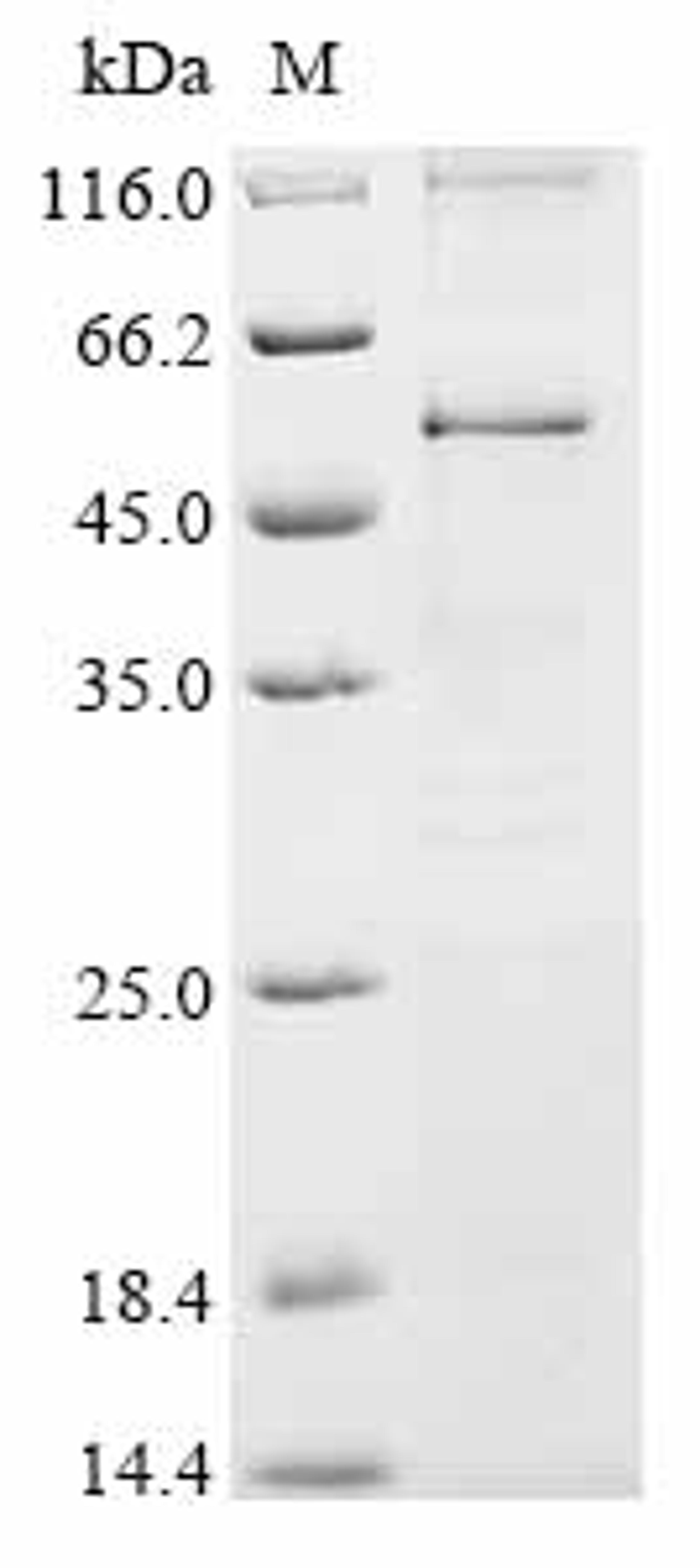 (Tris-Glycine gel) Discontinuous SDS-PAGE (reduced) with 5% enrichment gel and 15% separation gel.