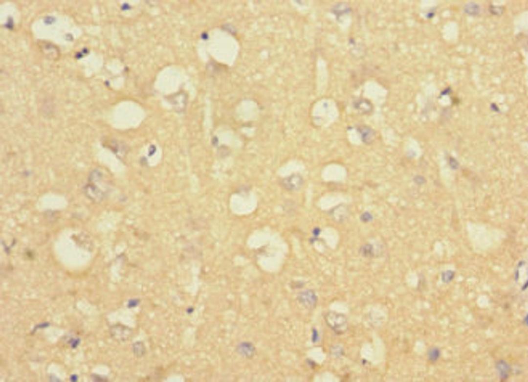 Immunohistochemistry of paraffin-embedded human brain tissue using CSB-PA888027LA01HU at dilution of 1:100