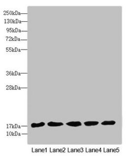 Western blot. All lanes: FAM96B antibody at 7.09µg/ml. Lane 1: Mouse gonadal tissue. Lane 2: MCF-7 whole cell lysate. Lane 3: Hela whole cell lysate. Lane 4: K562 whole cell lysate. Lane 5: A375 whole cell lysate. Secondary. Goat polyclonal to rabbit IgG at 1/10000 dilution. Predicted band size: 18 kDa. Observed band size: 18 kDa